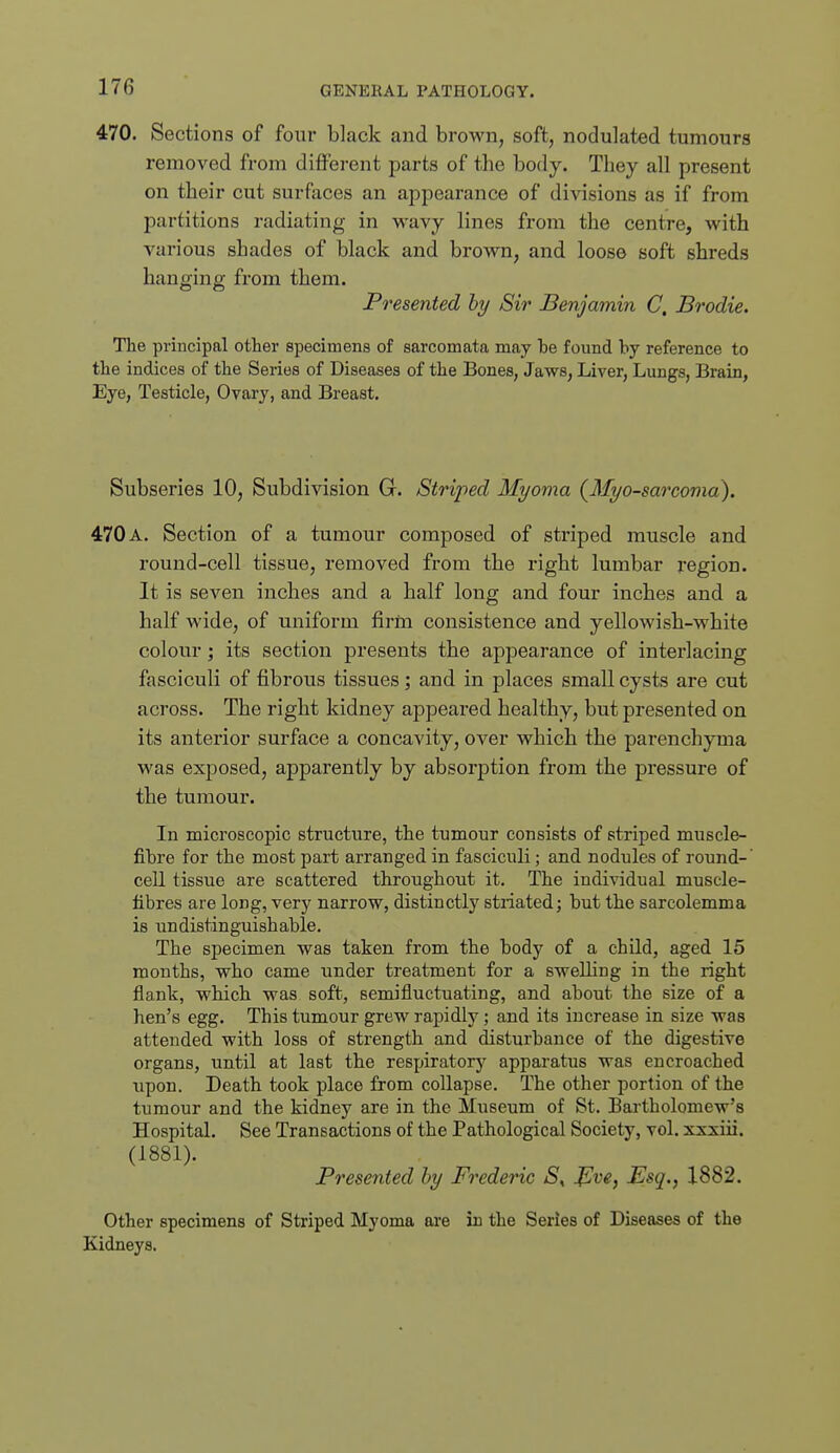 470. Sections of four black and brown, soft, nodulated tumours removed from difJ'erent parts of the body. They all present on their cut surfaces an appearance of divisions as if from partitions radiating in wa\y lines from the centre, with various shades of black and brown, and loose soft shreds hanging from them. Presented by Sir Benjamin C, Brodie. The principal other specimens of sarcomata may he found by reference to the indices of the Series of Diseases of the Bones, Jaws, Liver, Lungs, Brain, Eye, Testicle, Ovary, and Breast. Subseries 10, Subdivision G. Striped Myoma {Myosarcoma^. 470 a. Section of a tumour composed of striped muscle and round-cell tissue, removed from the right lumbar region. It is seven inches and a half long and four inches and a half wide, of uniform firm consistence and yellowish-white colour; its section presents the appearance of interlacing fasciculi of fibrous tissues; and in places small cysts are cut across. The right kidney appeared healthy, but presented on its anterior surface a concavity, over which the parenchyma was exposed, apparently by absorption from the pressure of the tumour. In microscopic structure, the tumour consists of striped muscle- fihre for the most part arranged in fasciculi; and nodules of round- cell tissue are scattered throughout it. The individual muscle- fibres are long, very narrow, distinctly striated; but the sarcolemma is un distinguish able. The specimen, was taken from the body of a child, aged 15 months, who came under treatment for a swelling in the right flank, which was soft, semifluctuating, and about the size of a hen's egg. This tumour grew rapidly; and its increase in size was attended with loss of strength and disturbance of the digestive organs, until at last the respiratory apparatus was encroached upon. Death took place from collapse. The other portion of the tumour and the kidney are in the Museum of St. Bartholomew's Hospital. See Transactions of the Pathological Society, vol. xxxiii. (1881). Presented by Frederic S, J^ve, Esq., 1882. Other specimens of Striped Myoma are in the Series of Diseases of the Kidneys.