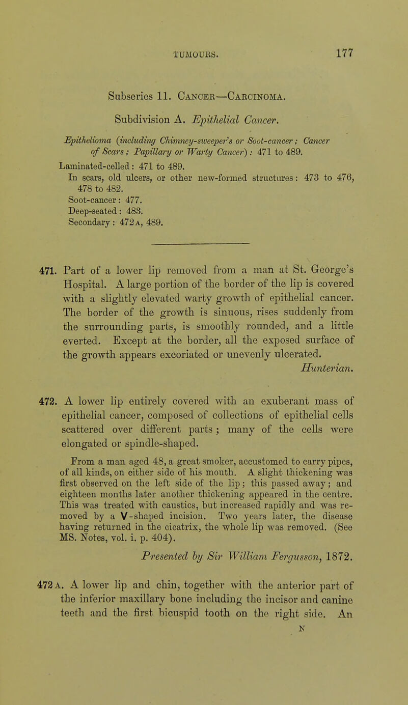 Subseries 11. C^iNCER—Oarcinobia. Subdivision A. Epithelial Cancer. Epithelioma {includiny dmnney-sweejjo-'s or Soot-cancer; Cancer of Scars; Papillary or Warty Cancer): All to 489. Laminated-celled: 471 to 489. In scars, old ulcers, or other new-formed structures: 473 to 476, 478 to 482. Soot-cancer: 477. Deep-seated: 483. Secondary: 472a, 489. 471. Part of a lower lip removed from a man at St. George's Hospital. A large portion of the border of the lip is covered with a slightly elevated warty growth of epithelial cancer. The border of the growth is sinuous, rises suddenly from the surrounding parts, is smoothly rounded, and a little everted. Except at the border, all the exposed surface of the growth appears excoriated or unevenly ulcerated. Hunterian. 472. A lower lip entirely covered with an exuberant mass of epithelial cancer, composed of collections of epithelial cells scattered over different parts; many of the cells were elongated or spindle-shaped. From a man aged 48, a great smoker, accustomed to carry pipes, of all kinds, on either side of his mouth. A slight thickening was first observed on the left side of the lip; this passed away; and eighteen months later another thickening appeared in the centre. This was treated with caustics, but increased rapidly and was re- moved by a V-shaped incision. Two years later, the disease having returned in the cicatrix, the whole lip was removed. (See MS. Notes, vol. i. p. 404). Presented by Sir William Fei'gmson, 1872. 472 a. a lower lip and chin, together with the anterior part of the inferior maxillary bone including the incisor and canine teeth and the first bicuspid tooth on the right side. An N