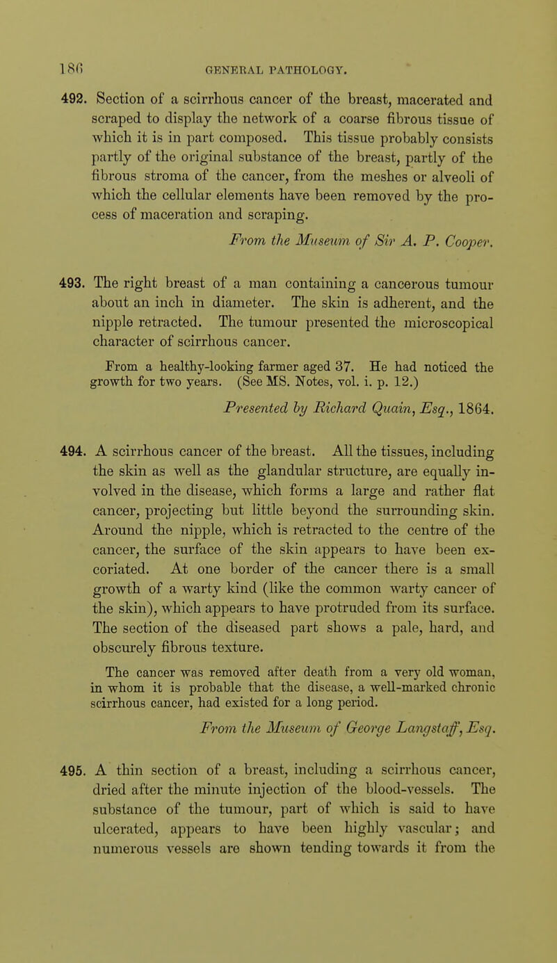 492. Section of a scirrhous cancer of the breast, macerated and scraped to display the network of a coarse fibrous tissue of which it is in part composed. This tissue probably consists partly of the original substance of the breast, partly of the fibrous stroma of the cancer, from the meshes or alveoli of which the cellular elements have been removed by the pro- cess of maceration and sci*aping. From the Museum of Sir A. P. Cooper. 493. The right breast of a man containing a cancerous tumour about an inch in diameter. The skin is adherent, and the nipple retracted. The tumour presented the microscopical character of scirrhous cancer. From a healthy-looking farmer aged 37. He had noticed the growth for two years. (See MS. Notes, vol. i. p. 12.) Presented hy Richard Quain, Esq., 1864. 494. A scirrhous cancer of the breast. All the tissues, including the skin as well as the glandular structure, are equally in- volved in the disease, which forms a large and rather flat cancer, projecting but little beyond the surrounding skin. Around the nipple, which is retracted to the centre of the cancer, the surface of the skin appears to have been ex- coriated. At one border of the cancer there is a small growth of a warty kind (like the common warty cancer of the skin), which appears to have protruded from its surface. The section of the diseased part shows a pale, hard, and obscm-ely fibrous texture. The cancer was removed after death from a very old woman, in whom it is probable that the dis well-marked chronic scirrhous cancer, had existed for a long period. From the Museum of George Lang staff, Esq. 495. A thin section of a breast, including a scirrhous cancer, dried after the minute injection of the blood-vessels. The substance of the tumour, part of which is said to have ulcerated, appears to have been highly vascular; and numerous vessels are shown tending towards it from the
