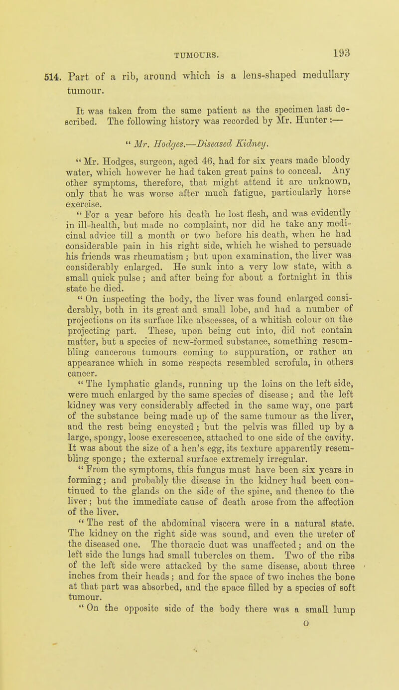 514. Part of a rib, around which is a lens-shaped medullary tumour. It was taken from the same patient as the specimen last de- scribed. The folio-wing history was recorded by Mr. Hunter :—  Mr. Hodges.—Diseased Kidney.  Mr. Hodges, surgeon, aged 46, had for six years made bloody water, which however he had taken great pains to conceal. Any other symptoms, therefore, that might attend it are unknown, only that he was worse after much fatigue, particularly horse exercise.  Por a year before his death he lost flesh, and was evidently in ill-health, but made no complaint, nor did he take any medi- cinal advice till a month or two before his death, when he had considerable pain in his right side, which he wished to persuade his friends was rheumatism; but upon examination, the liver was considerably enlarged. He sunk into a very low state, with a small quick pulse ; and after being for about a fortnight in this state he died. *' On inspecting the body, the liver was found enlarged consi- derably, both in its great and small lobe, and had a number of projections on its surface like abscesses, of a whitish colour on the projecting part. These, upon being cut into, did not contain matter, but a species of new-formed substance, something resem- bling cancerous tumours coming to suppuration, or rather an appearance which in some respects resembled scrofula, in others cancer.  The lymphatic glands, running up the loins on the left side, were much enlarged by the same species of disease; and the left kidney was very considerably affected in the same way, one part of the substance being made up of the same tumour as the liver, and the rest being encysted; but the pelvis was filled up by a large, spongy, loose excrescence, attached to one side of the cavity. It was about the size of a hen's egg, its texture apparently resem- bling sponge; the external surface extremely irregular.  Prom the symptoms, this fungus must have been six years in forming; and probably the disease in the kidney had been con- tinued to the glands on the side of the spine, and thence to the liver; but the immediate cause of death arose from the affection of the liver.  The rest of the abdominal viscera were in a natural state. The kidney on the right side was sound, and even the ureter of the diseased one. The thoracic duct was unaffected; and on the left side the lungs had small tubercles on them. Two of the ribs of the left side were attacked by the same disease, about three inches from their heads; and for the space of two inches the bone at that part was absorbed, and the space filled by a species of soft tumour.  On the opposite side of the body there was a small lump o