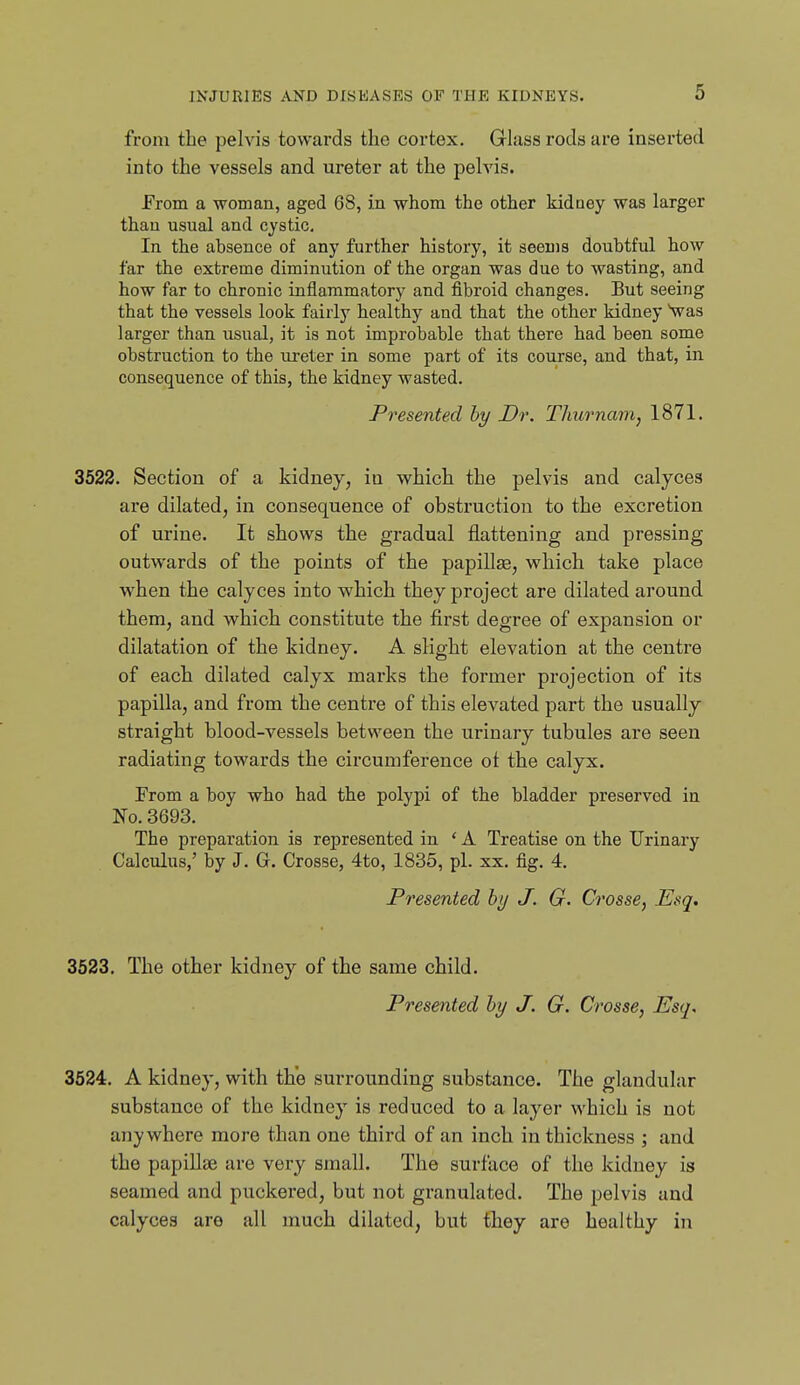 from the pelvis towards the cortex. Glass rods are insei'ted into the vessels and ureter at the pelvis. From a woman, aged 68, in whom the other kidney was larger than usual and cystic. In the absence of any further history, it seems doubtful how far the extreme diminution of the organ was due to wasting, and how far to chronic inflammatory and fibroid changes. But seeing that the vessels look fairly healthy and that the other kidney Vas larger than usual, it is not improbable that there had been some obstruction to the ureter in some part of its course, and that, in consequence of this, the kidney wasted. Presented by Dr. Thurnam, 1871. 3522. Section of a kidney, iu which the pelvis and calyces are dilated, in consequence of obstruction to the excretion of urine. It shows the gradual flattening and pressing outwards of the points of the papilla3, which take place when the calyces into which they project are dilated around them, and which constitute the first degree of expansion or dilatation of the kidney. A slight elevation at the centre of each dilated calyx marks the former projection of its papilla, and from the centre of this elevated part the usually straight blood-vessels between the urinary tubules are seen radiating towards the circumference ot the calyx. From a boy who had the polypi of the bladder preserved in No. 3693. The preparation is represented iu ' A Treatise on the Urinary Calculus,' by J. G. Crosse, 4to, 1835, pi. xx. fig. 4. Presented by J. G. CrossCy Esq. 3623. The other kidney of the same child. Presented by J. G. Crosse, Esq. 3624. A kidney, with the surrounding substance. The glandular substance of the kidney is reduced to a layer which is not anywhere more than one third of an inch in thickness ; and the papiUse are very small. The surface of the kidney is seamed and puckered, but not granulated. The pelvis and calyces are all much dilated, but they are healthy in