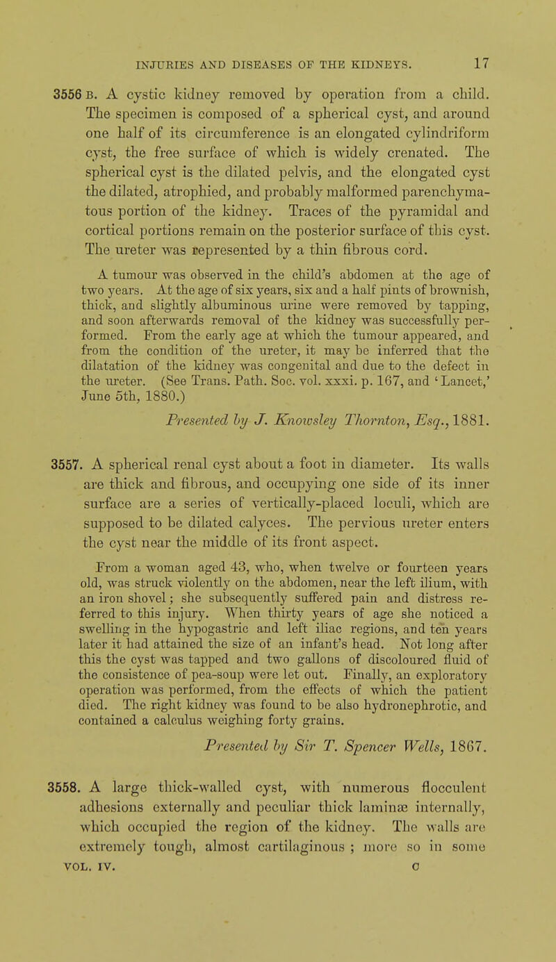 3656 b, a cystic kidney removed by operation from a child. The specimen is composed of a spherical cyst, and around one half of its circumference is an elongated cylindriform cyst, the free surface of which is widely crenated. The spherical cyst is the dilated pelvis, and the elongated cyst the dilated, atrophied, and probably malformed parenchyma- tous portion of the kidney. Traces of the pyramidal and cortical portions remain on the posterior surface of this cyst. The ureter was represented by a thin fibrous cord. A tumom' was observed in the cliild's abdomen at the age of two years. At the age of six years, six and a half pints of brownish, thick, and slightly albuminous mine were removed by tapping, and soon afterwards removal of the kidney was successfully per- formed. From the early age at which the tumour appeared, and from the condition of the ureter, it may be inferred that the dilatation of the kidney was congenital and due to the defect in the iireter. (See Trans. Path. Soc. vol. xxxi. p. 167, and 'Lancet,' June 5th, 1880.) Presented hy J. Knoiosley Thornton, Esq., 1881. 3557. A spherical renal cyst about a foot in diameter. Its walls are thick and fibrous, and occupying one side of its inner surface are a series of vertically-placed loculi, which are supposed to be dilated calyces. The pervious ureter enters the cyst near the middle of its front aspect. Prom a woman aged 43, who, when twelve or fourteen years old, was struck violently on the abdomen, near the left ilium, with an iron shovel; she subsequently suffered pain and distress re- ferred to this injury. When thirty years of age she noticed a swelling in the hypogastric and left iliac regions, and ten years later it had attained the size of an infant's head. Not long after this the cyst was tapped and two gallons of discoloured fluid of the consistence of pea-soup were let out. Finally, an exploratory operation was performed, from the effects of which the patient died. The right kidney was found to be also hydronephrotic, and contained a calculus weighing forty grains. Pi'esented hy Sir T. Spencer Wells, 1867. 3668. A large thick-walled cyst, with numerous flocculent adhesions externally and peculiar thick laminae internally, which occupied the region of the kidney. The walls are extremely tough, almost cartilaginous ; more so in some VOL. IV. 0