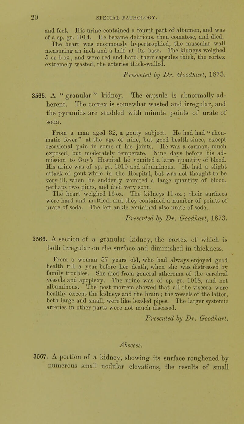 and feet. His urine contained a fourth part of albumen, and was of a sp. gr. 1014. He became delirious, then comatose, and died. The heart was enormously hypertrophied, the muscular waU measuring an inch and a half at its base. The kidneys weighed 5 or 6 oz., and were red and hard, their capsules thick, the cortex extremely wasted, the arteries thick-walled. Presented by Dr. Goodhart, 1873. 3565. A  granular  kidney. The capsule is abnormally ad- herent. The cortex is somewhat wasted and irregular, and the pyramids are studded with minute points of urate of soda. From a man aged 32, a gouty subject. He had had  rheu- matic fever at the ago of nine, but good health since, excejit occasional pain in some of his joints. He was a carman, much exposed, but moderatelj'^ temperate. Nine days before his ad- mission to Guy's Hospital he vomited a large quantity of blood. His urine was of sp. gr. 1010 and albuminous. He had a slight attack of gout while in the Hospital, but was not thought to be very ill, when ho suddenly vomited a large quantity of blood, perhaps two pints, and died very soon. The heart weighed 16oz. The kidneys 11 oz.; their surfaces were hard and mottled, and they contained a number of points of urate of soda. The left ankle contained also urate of soda. Presented by Dr. Goodhart, 1873. 3566. A section of a granular kidney, the cortex of which is both irregular on the surface and diminished in thickness. From a woman 67 years old, who had always enjoyed good health till a year before her death, when she was distressed by family troubles. She died from general atheroma of the cerebral vessels and apoplexy. The urine was of sp. gr. 1018, and not albuminous. The post-mortem showed that all the viscera were healthy except the kidneys and the brain ; the vessels of the latter, both large and small, were like beaded pipes. The larger systemic arteries in other parts were not much diseased. Presented by Dr. Goodhart. Abscess. 3567. A portion of a kidney, showing its surface roughened by numerous small nodular elevations, the results of small