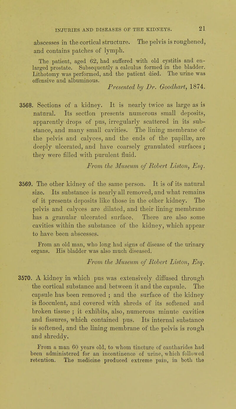abscesses in the cortical structure. The pelvis is roughened, and contains patches of lymph. The patient, aged 62, had suffered with old cystitis and en- larged prostate. Subsequently a calculus formed in the bladder. Lithotomy was performed, and the patient died. The urine was offensive and albuminous. Presented hy Dr. Goodhart, 1874. 3568. Sections of a kidney. It is nearly twice as large as is natural. Its section presents numerous small deposits, apparently drops of pus, irregularly scattered in its sub- stance, and many small cavities. The lining membrane of the pelvis and calyces, and the ends of the papillse, are deeply ulcerated, and have coarsely granulated surfaces ; they were filled with purulent fluid. From the Museum of Robert Liston, Esq. 3569. The other kidney of the same person. It is of its natural size. Its substance is nearly all removed, and what remains of it presents deposits like those in the other kidney. The pelvis and calyces are dilated, and their lining membrane has a granular ulcerated surface. There are also some cavities within the substance of the kidney, which appear to have been abscesses. Prom an old man, who long had signs of disease of the urinary organs. His bladder was also much diseased. From the Museum of Robert Liston, Esq. 3570. A kidney in which pus was extensively diffused through the cortical substance and between it and the capsule. The capsule has been removed j and the surface of the kidney is flocculent, and covered with shreds of its softened and broken tissue ; it exhibits, also, numerous minute cavities and fissures, which contained pus. Its internal substance is softened, and the lining membrane of the pelvis is rough and shreddy. From a man 60 years old, to whom tincture of cantharides had been administered for an iiicontinonco of urine, which followed retention. The medicine produced extreme pain, in both the