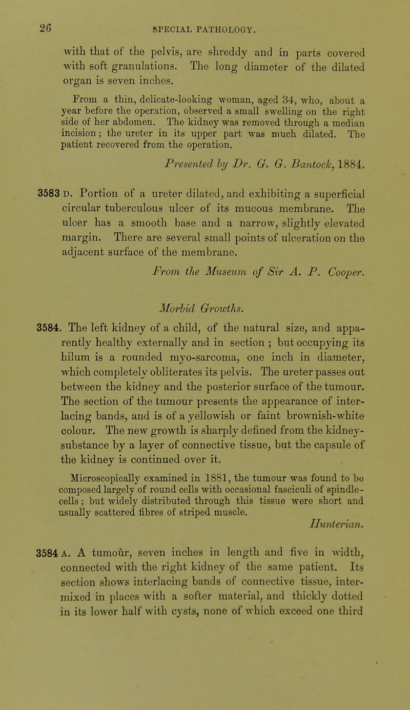 with that of the pelvis, are shreddy and in parts covered with soft granulations. The long diameter of the dilated organ is seven inches. From a thin, delicate-looking woman, aged 34, who, about a year before the operation, observed a small swelling on the right side of her abdomen. The kidney was removed through a median incision; the ureter in its upper part was much dilated. The patient recovered from the operation. Presented hy Dr. G. G. Bantock, 1884. 3583 D. Portion of a ureter dilated, and exhibiting a superficial circular tuberculous ulcer of its mucous membrane. The ulcer has a smooth base and a narrow, slightly elevated margin. There are several small points of ulceration on the adjacent surface of the membrane. From the Museum of Sir A. P. Cooper. Morhid Growths. 3584. The left kidney of a child, of the natural size, and appa- rently healthy externally and in section ; but occupying its hilum is a rounded myo-sarcoma, one inch in diameter, which completely obliterates its pelvis. The ureter passes out between the kidney and the posterior surface of the tumour. The section of the tumour presents the appearance of inter- lacing bands, and is of a yellowish or faint brownish-white colour. The new growth is sharply defined from the kidney- substance by a layer of connective tissue, but the capsule of the kidney is continued over it. Microscopically examined in 1881, the tumour was found to bo composed largely of round cells with occasional fasciculi of spindle- cells ; but widely distributed through this tissue were short and usually scattered fibres of striped muscle. Hunterian. 3584 A. A tumoiir, seven inches in length and five in width, connected with the right kidney of the same patient. Its section shows interlacing bands of connective tissue, inter- mixed in places with a softer material, and thickly dotted in its lower half with cysts, none of which exceed one third
