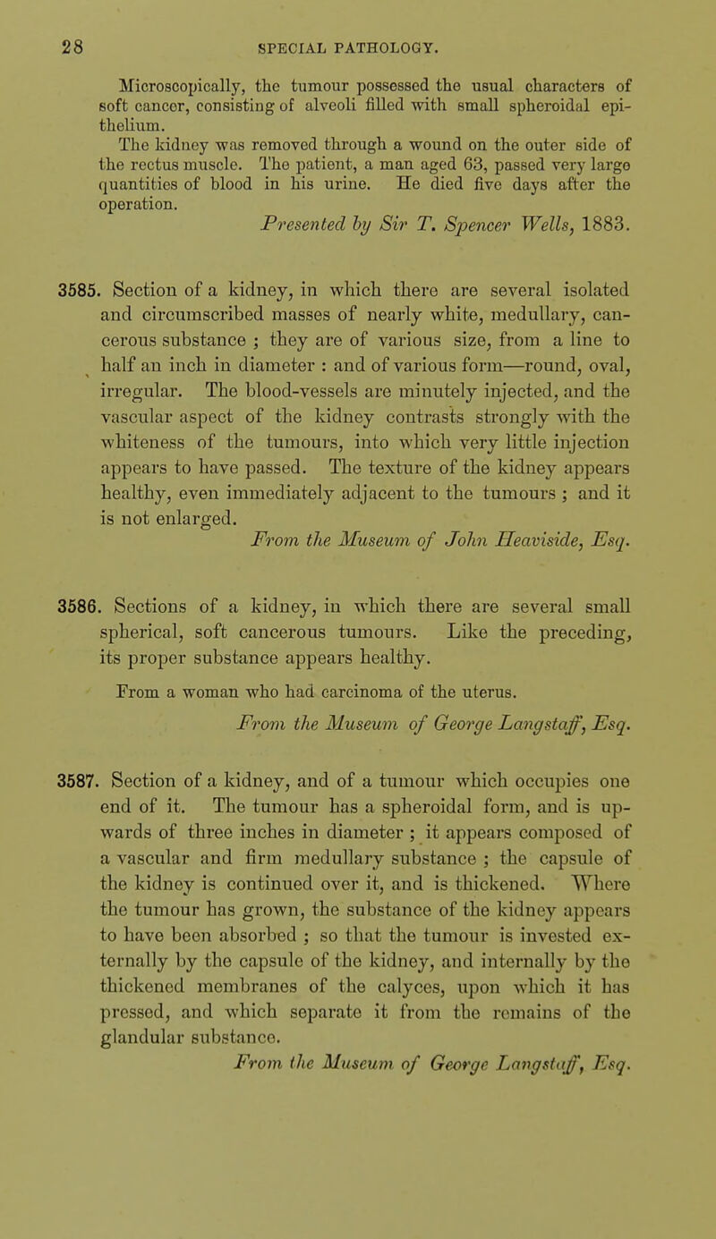 Microscopically, the tumour possessed the usual characters of soft cancer, consisting of alveoli filled with small spheroidal epi- thelium. The kidney was removed through a wound on the outer side of the rectus muscle. The patient, a man aged 63, passed very largo quantities of blood in his urine. He died five days after the operation. Presented hy Sir T. Spencer Wells, 1883. 3585. Section of a kidney, in which there are several isolated and circumscribed masses of nearly white, medullary, can- cerous substance ; they are of various size, from a line to half an inch in diameter : and of various form—round, oval, irregular. The blood-vessels are minutely injected, and the vascular aspect of the kidney contrasts strongly with the whiteness of the tumours, into which very little injection appears to have passed. The texture of the kidney appears healthy, even immediately adjacent to the tumours ; and it is not enlarged. From the Museum of John Heaviside, Esq. 3586. Sections of a kidney, in which there are several small spherical, soft cancerous tumours. Like the preceding, its proper substance appears healthy. From a woman who had carcinoma of the uterus. From the Museum of George Langstaff, Esq. 3587. Section of a kidney, and of a tumour which occupies one end of it. The tumour has a spheroidal form, and is up- wards of three inches in diameter ; it appears composed of a vascular and firm medullary substance ; the capsule of the kidney is continued over it, and is thickened. Where the tumour has grown, the substance of the kidney appears to have been absorbed ; so that the tumour is invested ex- ternally by the capsule of the kidney, and internally by the thickened membranes of the calyces, upon which it has pressed, and which separate it from the remains of the glandular substance. From the Museum of George Langstaff, Esq.