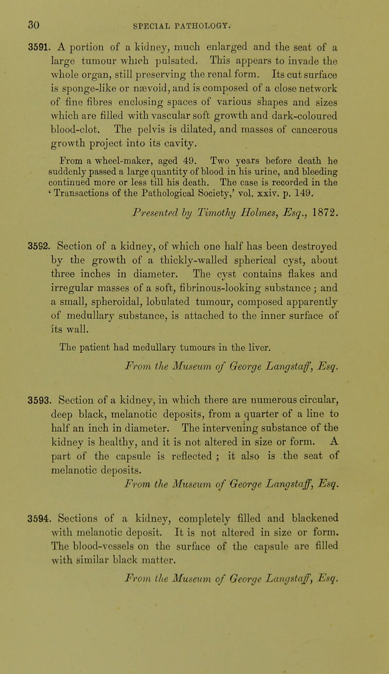 3591. A portion of a kidney, much enlarged and the seat of a large tumour which pulsated. This apjjears to invade the whole organ, still preserving the renal form. Its cut surface is sponge-like or na3void, and is composed of a close network of fine fibres enclosing spaces of various shapes and sizes which are filled with vascular soft growth and dark-coloured blood-clot. The pelvis is dilated, and masses of cancerous growth project into its cavity. From a wheel-maker, aged 49. Two years before death he suddenly passed a large quantity of blood in bis urine, and bleeding continued more or less till his death. The case is recorded in the ' Transactions of the Pathological Society,' vol. xxiv. p. 149. Presented hy Timothy Holmes, Esq., 1872. 3592. Section of a kidney, of which one half has been destroyed by the growth of a thickly-walled spherical cyst, about three inches in diameter. The cyst contains flakes and irregular masses of a soft, fibrinous-looking substance ; and a small, spheroidal, lobulated tumour, composed apparently of medullary substance, is attached to the inner surface of its wall. The patient had medullary tumours in the liver. From the Museum of George Langstaf, Esq. 3593. Section of a kidney, in which there are numerous circular, deep black, melanotic deposits, from a quarter of a line to half an inch in diameter. The intervening substance of the kidney is healthy, and it is not altered in size or form. A part of the capsule is reflected ; it also is the seat of melanotic deposits. From the Museum of George Lang staff, Esq. 3594. Sections of a kidney, completely filled and blackened with melanotic deposit. It is not altered in size or form. The blood-vessels on the surface of the capsule are filled with similar black matter.