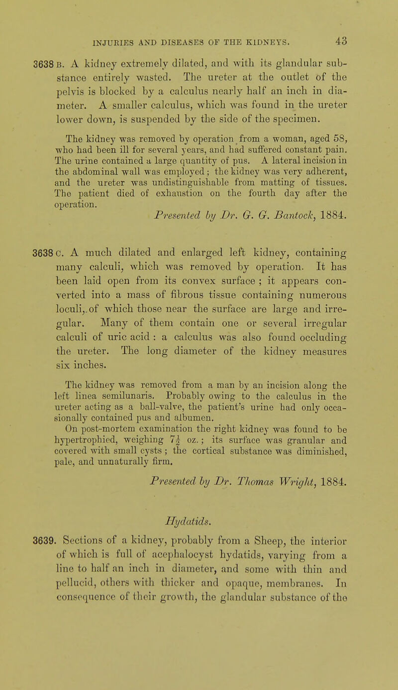 3638 b. a kidney extremely dilated, and with its glandular sub- stance entirely wasted. The ureter at the outlet of the pelvis is blocked by a calculus nearly half an inch in dia- meter. A smaller calculus, which was found in the ureter lower down, is suspended by the side of the specimen. The kidney was removed by operation from a woman, aged 58, who had been ill for several years, and had suffered constant pain. The urine contained a large quantity of pus. A lateral incision in the abdominal wall was employed; the kidney was very adherent, and the ureter was undistinguishable from matting of tissues. The patient died of exhaustion on the fourth day after the operation. Presented by Dr. G. G. Bantock, 1884. 3638 c. A much dilated and enlarged left kidney, containing many calculi, which was removed by operation. It has been laid open from its convex surface ; it appears con- verted into a mass of fibrous tissue containing numerous loculij.of which those near the surface are large and irre- gular. Many of them contain one or several irregular calculi of uric acid : a calculus was also found occluding the ureter. The long diameter of the kidney measures six inches. The kidney was removed from a man by an incision along the left linea semilunaris. Probably owing to the calculus in the ureter acting as a ball-valre, the patient's urine bad only occa- sionally contained pus and albumen. On post-mortem examination the right kidney was found to be hypertrophiod, weighing 7| oz.; its surface was granular and covered with small cysts ; the cortical substance was diminished, pale, and unnaturally firm. Presented by Dr. Thomas Wright, 1884. Hydatids. 3639. Sections of a kidney, probably from a Sheep, the interior of which is full of acepbalocyst hydatids, varying from a line to half an inch in diameter, and some with thin and pellucid, others with thicker and opaque, membranes. In consequence of their growth, the glandular substance of the
