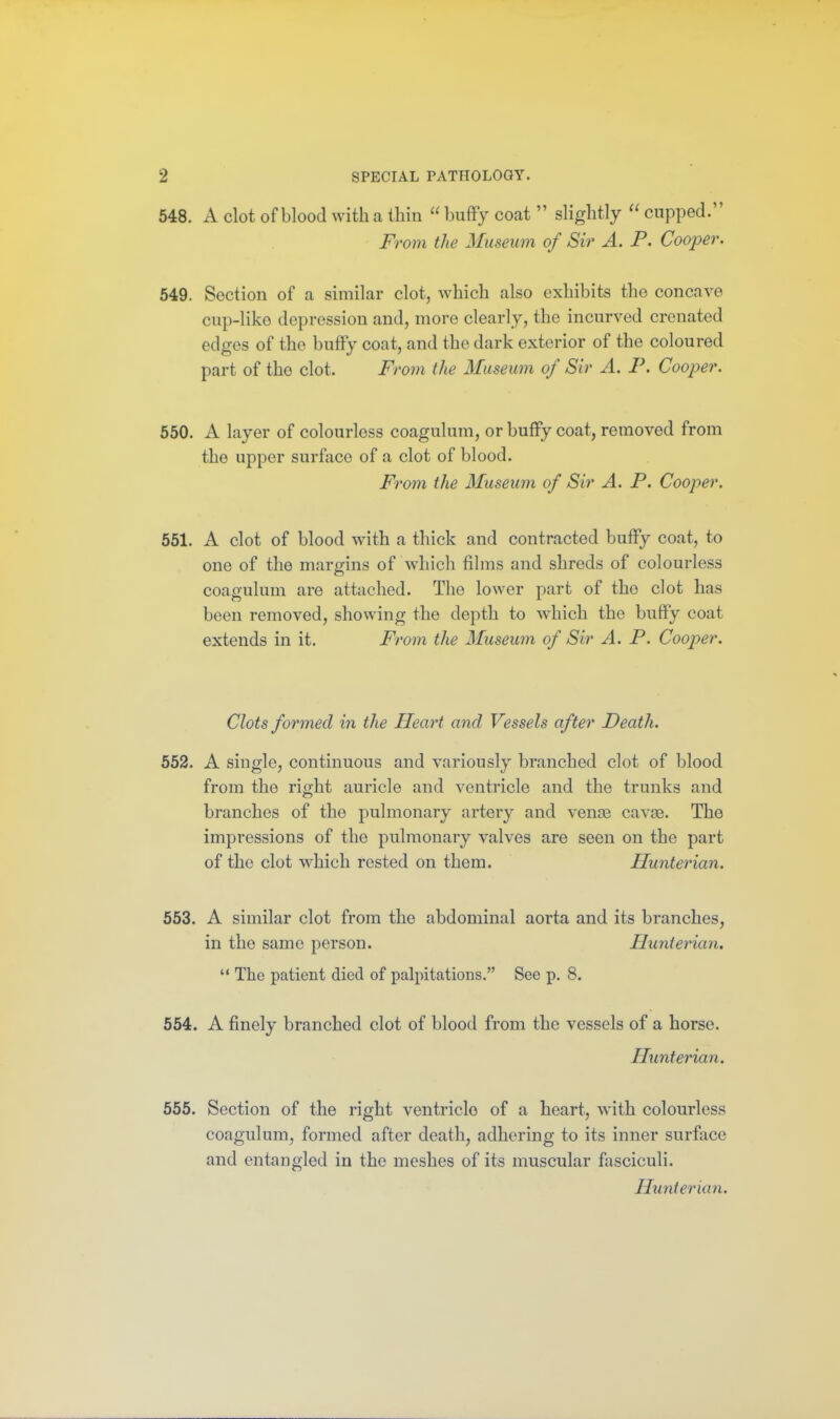548. A clot of blood with a thin  bufFy coat  slightly  cupped. From the Museum of Sir A. P. Cooper. 549. Section of a similar clot, which also exhibits the concave cup-like depression and, more clearly, the incurved crenated edges of the huffy coat, and the dark exterior of the coloured part of the clot. From the Museum of Sir A. P. Cooper. 550. A layer of colourless coagulum, or bufFy coat, removed from the upper surface of a clot of blood. From the Museum of Sir A. P. Cooper. 551. A clot of blood with a thick and contracted buffy coat, to one of the margins of which films and shreds of colourless coagulum are attached. The lower part of the clot has been removed, showing the depth to Avhich the buffy coat extends in it. From the Museum of Sir A. P. Cooper. Clots formed in the Heart and Vessels after Death. 552. A single, continuous and variously branched clot of blood from the right auricle and ventricle and the trunks and branches of the pulmonary artery and venae cavse. The impressions of the pulmonary valves are seen on the part of the clot w^hich rested on them. Hunterian. 553. A similar clot from the abdominal aorta and its branches, in the same person. Hunterian.  The patient died of palpitations. See p. 8. 554. A finely branched clot of blood from the vessels of a horse. Hunterian, 555. Section of the right ventricle of a heart, with colourless coagulum, formed after death, adhering to its inner surface and entangled in the meshes of its muscular fasciculi. Hunterian.