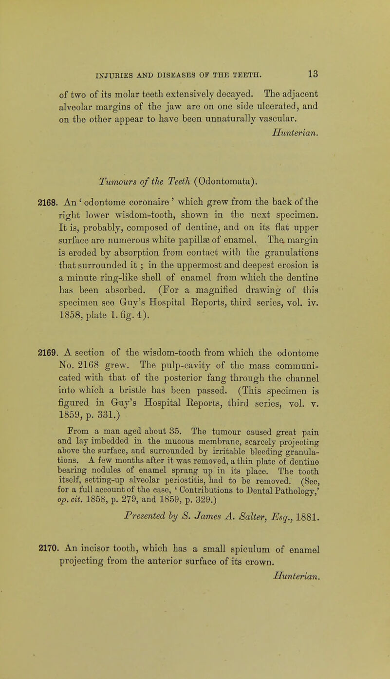 of two of its molar teeth extensively decayed. The adjacent alveolar margins of the jaw are on one side ulcerated, and on the other appear to have been unnaturally vascular. Hunterian. Tumours of the Teeth (Odontomata). 2168. An ' odontome coronaire ' which grew from the back of the right lower wisdom-tooth, shown in the next specimen. It is, probably, composed of dentine, and on its flat upper surface are numerous M'^hite papillae of enamel. Tha margin is eroded by absorption from contact with the granulations that surrounded it; in the uppermost and deepest erosion is a minute ring-like shell of enamel from which the dentine has been absorbed. (For a magnified drawing of this specimen see Guy's Hospital Reports, third series, vol. iv. 1858, plate 1. fig.'4). 2169. A section of the -wisdom-tooth from which the odontome No. 2168 grew. The pulp-cavity of the mass communi- cated with that of the posterior fang through the channel into which a bristle has been passed. (This specimen is figured in Guy's Hospital Reports, third series, vol. v. 1859, p. 331.) From a man aged about 35. The tumour caused great pain and lay imbedded in the mucous membrane, scarcely projecting above the surface, and surrounded by irritable bleeding granula- tions. A few months after it was removed, a thin plate of dentine bearing nodules of enamel sprang up in its place. The tooth itself, setting-up alveolar periostitis, had to be removed. (See, for a full account of the case, ' Contributions to Dental Pathology,' op. cit. 1858, p. 279, and 1859, p. 329.) Presented hy S. James A. Salter, Esq., 1881. 2170. An incisor tooth, which has a small spiculum of enamel projecting from the anterior surface of its crown. jETunterian.