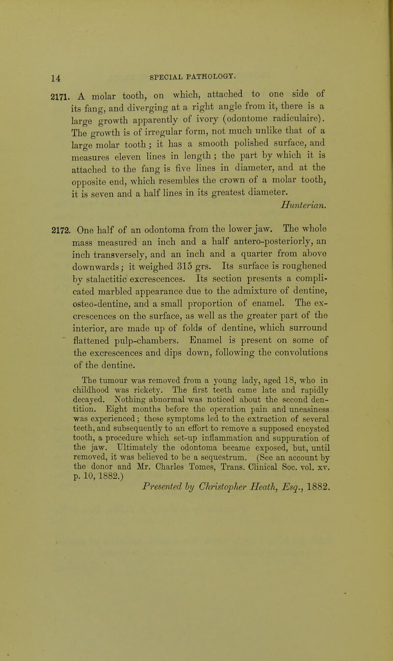 2171. A molar tooth, on which, attached to one side of its fang, and diverging at a right angle from it, there is a large growth apparently of ivory (odontome radiculaire). The growth is of irregular form, not much unlike that of a large molar tooth ; it has a smooth polished surface, and measures eleven lines in length ; the part by which it is attached to the fang is five lines in diameter, and at the opposite end, Avhich resembles the crown of a molar tooth, it is seven and a half lines in its greatest diameter. Hunterian. 2172. One half of an odontoma from the lower jaw. The whole mass measured an inch and a half antero-posteriorly, an inch transversely, and an inch and a quarter from above downwards; it weighed 315 grs. Its surface is roughened by stalactitic excrescences. Its section presents a compli- cated marbled appearance due to the admixture of dentine, osteo-dentine, and a small proportion of enamel. The ex- crescences on the surface, as well as the greater part of the interior, are made up of folds of dentine, which surround flattened pulp-chambers. Enamel is present on some of the excrescences and dips down, follo^'^'ing the convolutions of the dentine. The tumour was removed from a young lady, aged 18, who in childhood was rickety. The first teeth came late and rapidly decayed. Nothing abnormal was noticed about the second den- tition. Eight months before the operation pain and uneasiness was experienced; these symptoms led to the extraction of several teeth, and subsequently to an effort to remove a supposed encysted tooth, a procedure which set-up inflammation and supp\iration of the jaw. Ultimately the odontoma became exposed, but, untU removed, it was believed to be a sequestrum. (See an account by the donor and Mr. Charles Tomes, Trans. Clinical Soc. vol. xv. p. 10, 1882.) Presented hy Christopher Heath, Esq., 1882.