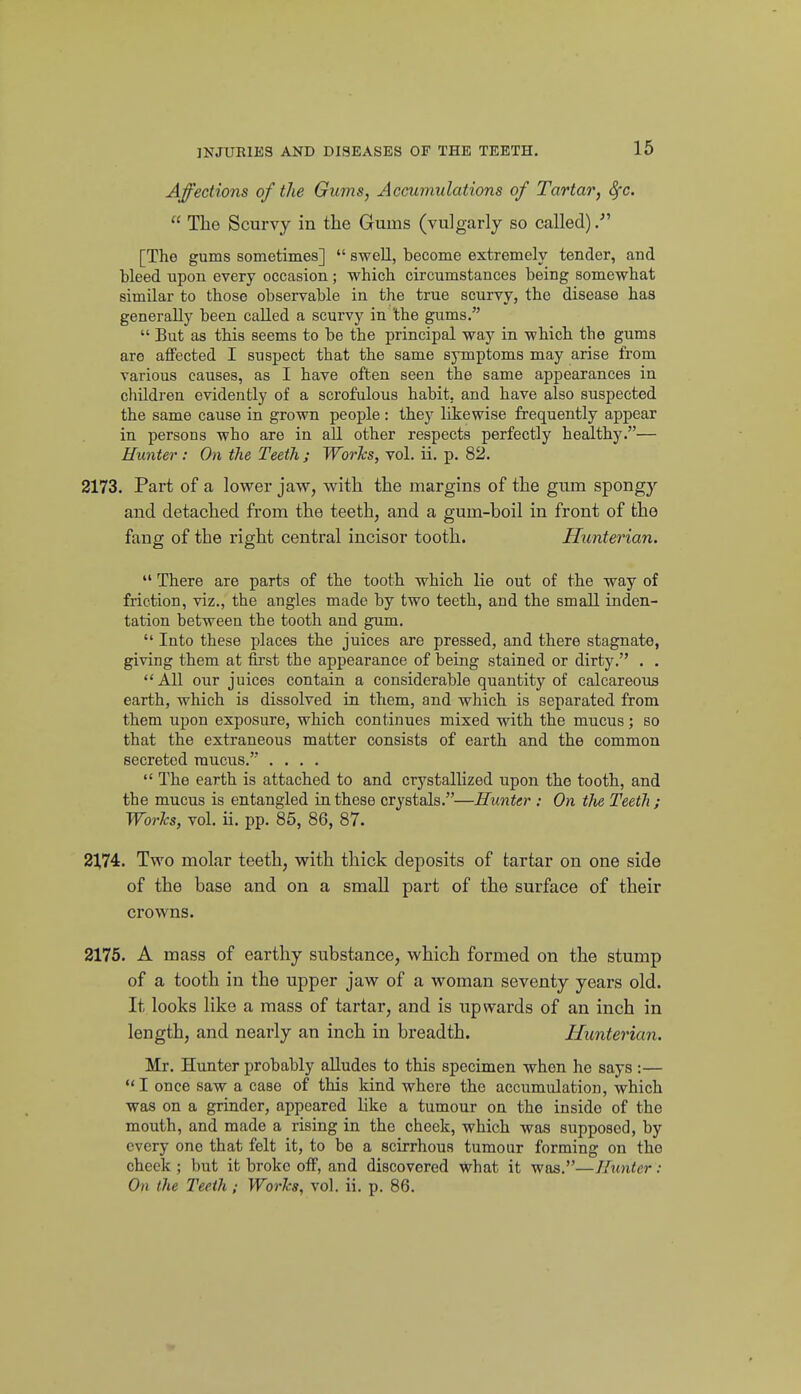 Affections of the Gums, Accumulations of Tartar, 8fc.  The Scurvy in the Gums (vulgarly so called) [The gums sometimes]  swell, become extremely tender, and bleed upon every occasion; which circumstances being somewhat similar to those observable in the true scurvy, the disease has generally been called a scurvy in the gums.  But as this seems to be the principal way in which the gums are affected I suspect that the same symptoms may arise from various causes, as I have often seen the same appearances in cliildren evidently of a scrofulous habit, and have also suspected the same cause in grown people: they likewise frequently appear in persons who are in all other respects perfectly healthy.— Hunter: On the Teeth ; Works, vol. ii. p. 82. 2173. Part of a lower jaw, with the margins of the gtim spongy and detached from the teeth, and a gum-boil in front of the fang of the right central incisor tooth. Hunterian.  There are parts of the tooth which lie out of the way of friction, viz., the angles made by two teeth, and the small inden- tation between the tooth and gum.  Into these places the juices are pressed, and there stagnate, giving them at first the appearance of being stained or dirty. . . All our juices contain a considerable quantity of calcareous earth, which is dissolved in them, and which is separated from them upon exposure, which continues mixed with the mucus; so that the extraneous matter consists of earth and the common secreted mucus.' ....  The earth is attached to and crystallized upon the tooth, and the mucus is entangled'm these crystals.—Hunter : On the Teeth ; Works, vol. ii. pp. 85, 86, 87. 21,74. Two molar teeth, with thick deposits of tartar on one side of the base and on a small part of the surface of their crowns. 2175. A mass of earthy substance, which formed on the stump of a tooth in the upper jaw of a woman seventy years old. It looks like a mass of tartar, and is upwards of an inch in length, and nearly an inch in breadth. Uunterian. Mr. Hunter probably alludes to this specimen when he says :— I once saw a case of this kind whore the accumulation, which was on a grinder, appeared like a tumour on the insido of the mouth, and made a rising in the cheek, which was supposed, by every one that felt it, to be a scirrhous tumour forming on the cheek ; but it broke otF, and discovered what it was.—Hunter: On the Teeth; Works, vol. ii. p. 86.