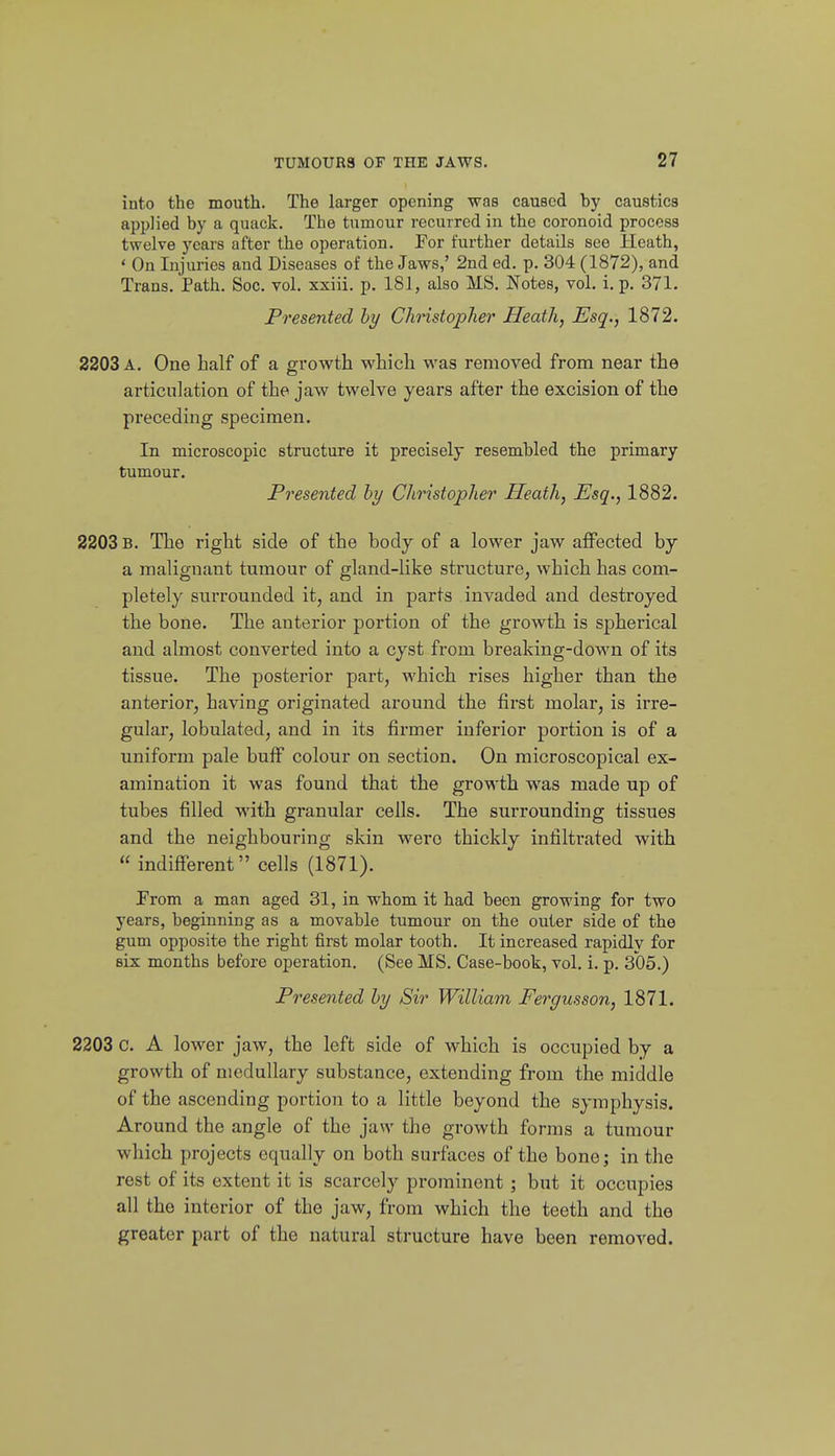 into the mouth. The larger opening was caused by caustics api)]ied by a quack. The tumour recurred in the coronoid process twelve j'-ears after the operation. For further details see Heath, ' On Injuries and Diseases of the Jaws,' 2nd ed. p. 304 (1872), and Trans. Path. Soc. vol. xxiii. p. 181, also MS. Notes, vol. i. p. 371. Presented hy Christopher Heath, Esq., 1872. 2203 A. One half of a growth which was removed from near the articulation of the jaw twelve years after the excision of the preceding specimen. In microscopic structure it precisely resembled the primary tumour. Presented by Christopher Heath, Esq., 1882. 2203 B. The right side of the body of a lower jaw affected by a malignant tumour of gland-like structure, which has com- pletely surrounded it, and in parts invaded and destroyed the bone. The anterior portion of the growth is spherical and almost converted into a cyst from breaking-down of its tissue. The posterior part, which rises higher than the anterior, having originated around the first molar, is irre- gular, lobulated, and in its firmer inferior portion is of a uniform pale buff colour on section. On microscopical ex- amination it was found that the growth was made up of tubes filled with granular cells. The surrounding tissues and the neighbouring skin were thickly infiltrated with  indifferent cells (1871). Prom a man aged 31, in whom it had been growing for two years, beginning as a movable tumour on the outer side of the gum opposite the right first molar tooth. It increased rapidly for six months before operation. (See MS. Case-book, vol. i. p. 305.) Presented hy Sir William Fergusson, 1871. 2203 C. A lower jaw, the left side of which is occupied by a growth of medullary substance, extending from the middle of the ascending portion to a little beyond the symphysis. Around the angle of the jaw the growth forms a tumour which projects equally on both surfaces of the bone; in the rest of its extent it is scarcely prominent ; but it occupies all the interior of the jaw, from which the teeth and the greater part of the natural structure have been removed.