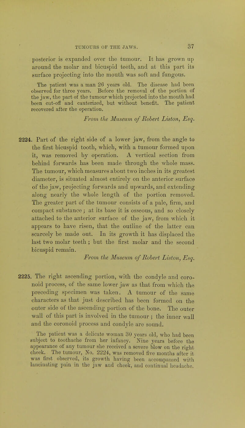 posterior is expanded over the tumour. It has grown up around the molar and bicuspid teeth, and at this part its surface projecting into the mouth was soft and fungous. The patient was a man 26 years old. The disease had been observed for three years. Before the removal of the portion of the jaw, the part of the tumour which projected into the mouth had been cut-ofE and cauterized, but without benefit. The patient recovered after the operation. Fo'om the Museum of Robert Liston^ Esq. 2224. Part of the right side of a lower jaw, from the angle to the first bicuspid tooth, which, with a tumour formed upon it, was removed by operation. A vertical section from behind forwards has been made through the whole mass. The tumour, which measures about two inches in its greatest diameter, is situated almost entirely on the anterior surface of the jaw, projecting forwards and upw^ards, and extending along nearly the whole length of the portion removed. The greater part of the tumour consists of a pale, firm, and compact substance j at its base it is osseous, and so closely attached to the anterior surface of the jaw, from which it appears to have risen, that the outline of the latter can scarcely be made out. In its growth it has displaced the last two molar teeth ; but the first molar and the second bicuspid remain. From the Museicm of Robert Liston, Esq. 2225. The right ascending portion, with the condyle and coro- noid process, of the same lower jaw as that from which the preceding specimen was taken. A tumour of the same characters as that just described has been formed on the outer side of the ascending portion of the bone. The outer wall of this part is involved in the tumour ; the inner wall and the coronoid process and condyle are sound. The patient was a delicate woman 30 years old, who had been subject to toothache from her infancy. Nine years before the appearance of any tumour she received a severe blow on the right cheek. The tumour, No. 2224, was removed five months after it was first observed, its growth having been accorapuiiicd with lancinating pain in the jaw and cheek, and continual headache.