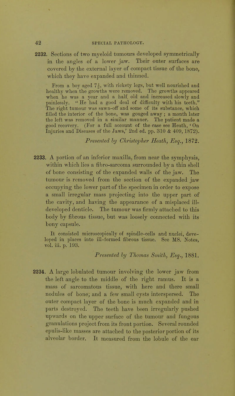 2232. Sections of two myeloid tumours developed symmetrically in the angles of a lower jaw. Their outer surfaces are covered by the external layer of compact tissue of the bone, which they have expanded and thinned. Prom a boy aged Yg, with rickety legs, but well nourished and healthy when the growths were removed. The growths appeared when he was a year and a half, old and increased slowly and painlessly.  He had a good deal of difficulty with his teeth. The right tumour was sawn-off and some of its substance, which filled the interior of the bone, was gouged away ; a month later the left was removed in a similar manner. The patient made a good recovery. (For a full account of the ease see Heath, ' On Injuries and Diseases of the Jaws,' 2nd ed. pp. 310 & 409,1872). Presented hy Christopher Heath, Esq., 1872. 2233. A portion of an inferior maxilla, from near the symphysis, within which lies a fibro-sarcoma surrounded by a thin shell of bone consisting of the expanded walls of the jaw. The tumour is removed from the section of the expanded jaw occupying the lower part of the specimen in order to expose a small irregular mass projecting into the upper part of the cavity, and having the appearance of a misplaced ill- developed denticle. The tumour was firmly attached to this body by fibrous tissue, but was loosely connected with its bony capsule. It consisted microscopically of spindle-cells and nuclei, deve- loped in places into iU-formed fibrous tissue. See MS. Notes, vol. iii. p. 193. Presented hy Thomas Smith, Esq., 1881. 2234. A large lobulated tumour involving the lower jaw from the left angle to the middle of the right ramus. It is a mass of sarcomatous tissue, with here and there small nodules of bone, and a few small cysts interspersed. The outer compact layer of the bone is much expanded and in parts destroyed. The teeth have been irregularly pushed upwards on the upper surface of the tumour and fungous granulations project from its front portion. Several rounded epulis-like masses are attached to the posterior portion of its alveolar border. It measured from the lobule of the ear