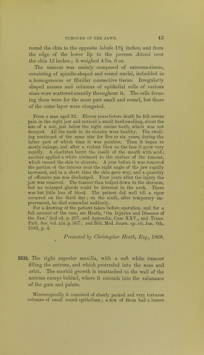 round the chin to the opposite lobule 19^ inches, and from the edge of the lower lip to the ponium Adami over the chin 13 inches ; it weighed 4 lbs. 6 oz. The tumour was mainly composed of sarcoma-tissue, consisting of spindle-shaped and round nuclei, imbedded in a homogeneous or fibrillar connective tissue. Irregularly- shaped masses and columns of epithelial cells of various sizes M'ere scattered scantily throughout it. The cells form- ing them were for the most part small and round, but those of the outer layer were elongated. From a man aged 32. Eleven years before death he felt severe pain in the right jaw and noticed a small hard swelling, about the size of a nut, just below the right canine tooth, which was not decayed. All the teeth in its vicinity were healthy. The swell- ing continued of the same size for five or six years, during the latter part of which time it was painless. Then it began to slowly enlarge, and after a violent blow on the face it grew very rapidly. A charlatan burnt the inside of the mouth with acid; another applied a white ointment to the surface of the tumour, which caused the skin to ulcerate, A year before it was removed the portion of the tumour near the right angle of the jaw rapidly increased, and in a short time the skin gave way, and a quantity of offensive pus was discharged, Tour years after the injury the jaw was removed. The tumour then bulged down to the sternum, but no enlarged glands could be detected in the neck. There was but little loss of blood. The patient did well till a rigor occurred on the third day; on the sixth, after temporary im- provement, he died somewhat suddenly. For a drawing of the patient taken before operation, and for a full account of the case, see Heath, ' On Injuries and Diseases of the Jaw,' 2nd ed. p. 297, and Appendix, Case XXV., and Trans. Path. Soc. vol. xix. p. 307; and Brit. Med. Journ. op. cit. Jan. 6th, 1883, p. 4. Presented by Christopher Heath, Esq., 1868. 2235. The right superior maxilla, with a soft white tumour filling the antrum, and which protruded into the nose and orbit. The morbid growth is unattached to the wall of the antrum except behind, where it extends into the substance of the gum and palate. Microscopically it consisted of closely packed and very tortuous columns of small round epithelium; a few of them had a lumen
