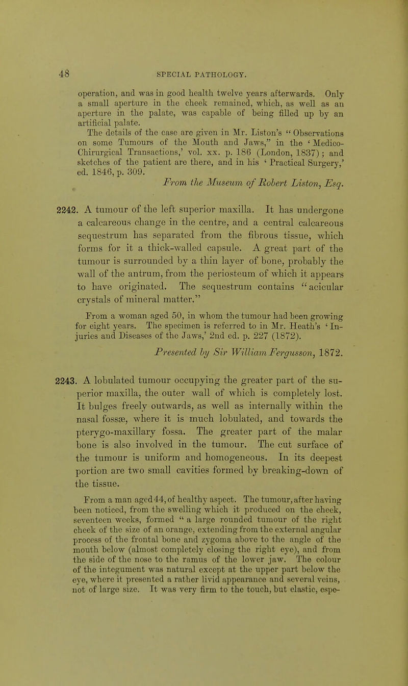 operation, and was in good health twelve years afterwards. Onlj' a small aperture in the cheek remained, which, as well as an aperture in the palate, was capable of being filled up by an artificial palate. The details of the case are given in Mr. Listen's  Observations on some Tumours of the Mouth and Jaws, in the ' Medico- Chirurgical Transactions,' vol. xx. p. 186 (London, 1837); and sketches of the patieut are there, and in his ' Practical Surgery,' ed. 1846, p. 309. From the Museum of Robert Liston, Esq. 2242. A tumour of the left superior maxilla. It has undergone a calcareous change in tlie centre, and a central calcareous sequestrum has separated from the fibrous tissue, which forms for it a thick-walled capsule. A great part of the tumour is surrounded by a thin layer of bone, probably the wall of the antrum, from the periosteum of which it appears to have originated. The sequestrum contains acicular crystals of mineral matter. Prom a woman aged 50, in whom the tumour had been growing for eight years. The specimen is referred to in Mr. Heath's ' In- juries and Diseases of the Jaws,' 2nd ed. p. 227 (1872). Presented by Sir William Fergusson, 1872. 2243. A lobulated tumour occupying the greater part of the su- perior maxilla, the outer wall of which is completely lost. It bulges freely outwards, as well as internally within the nasal fossae, where it is much lobulated, and towards the pterygo-maxillary fossa. The greater part of the malar bone is also involved in the tumour. The cut surface of the tumour is uniform and homogeneous. In its deepest portion are two small cavities formed by breaking-doAvn of the tissue. From a man aged 44, of healthy aspect. The tumour, after having been noticed, from the swelling which it produced on the cheek, seventeen weeks, formed  a lai-ge rounded tumour of the right cheek of the size of an orange, extending from the external angular process of the frontal bone and zygoma above to the angle of the mouth below (almost completely closing the right eye), and from the side of the nose to the ramus of the lower jaw. The colour of the integument was natural except at the upper part below the eye, where it presented a rather livid ajipearauce and several veins, not of large size. It was very firm to the touch, but elastic, cspe-