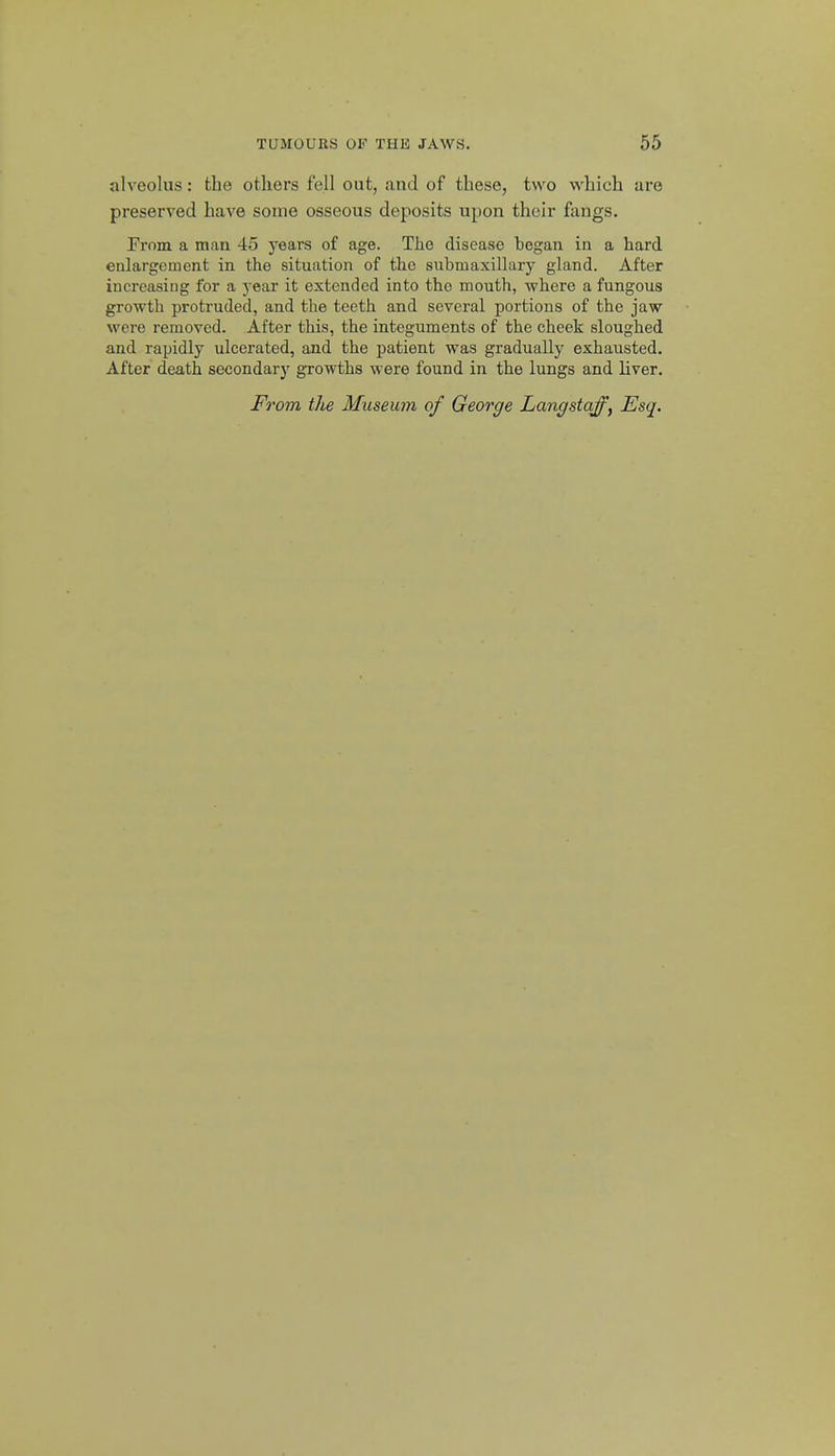 alveolus: the others fell out, and of these, two which are preserved have some osseous deposits upon their fangs. Prom a man 45 years of age. The disease began in a hard enlargement in the situation of the submaxillary gland. After increasing for a year it extended into the mouth, where a fungous growth protruded, and the teeth and several portions of the jaw were removed. After this, the integuments of the cheek sloughed and rapidly ulcerated, and the patient was gradually exhausted. After death secondary growths were found in the lungs and liver.
