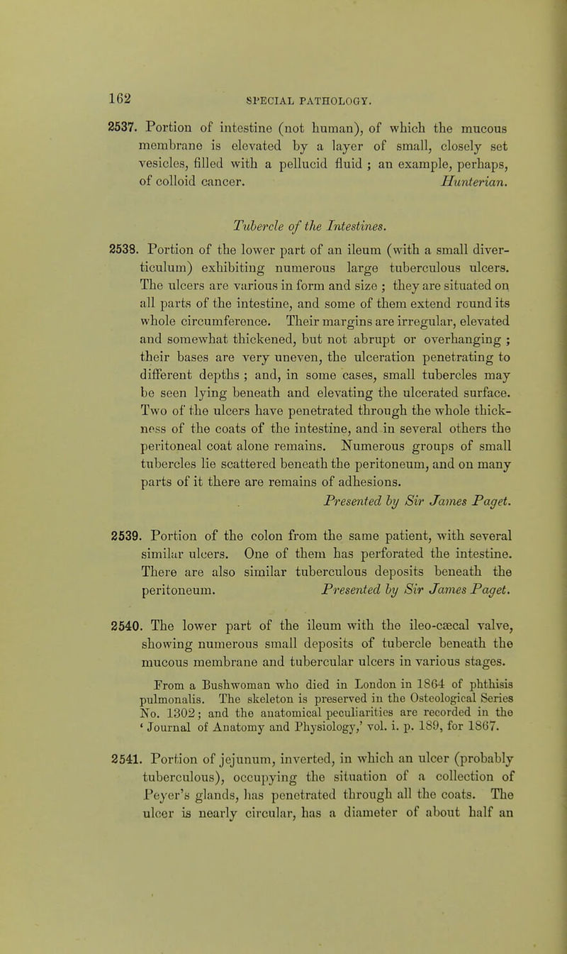 2537. Portion of intestine (not human), of which the mucous membrane is elevated by a layer of small, closely set vesicles, filled with a pellucid fluid ; an example, perhaps, of colloid cancer. Hunterian. Tubercle of the Intestines. 2538. Portion of the lower part of an ileum (with a small diver- ticulum) exhibiting numerous large tuberculous ulcers. The ulcers are various in form and size ; they are situated on all parts of the intestine, and some of them extend round its whole circumference. Their margins are iri-egular, elevated and somewhat thickened, but not abrupt or overhanging ; their bases are very uneven, the ulceration penetrating to different depths ; and, in some cases, small tubercles may be seen lying beneath and elevating the ulcerated surface. Two of the ulcers have penetrated through the whole thick- ness of the coats of the intestine, and in several others the peritoneal coat alone remains. Numerous groups of small tubercles lie scattered beneath the peritoneum, and on many parts of it there are remains of adhesions. Presented by Sir James Paget. 2539. Portion of the colon from the same patient, with several similar ulcers. One of them has perforated the intestine. There are also similar tuberculous deposits beneath the peritoneum. Presented by Sir James Paget. 2540. The lower part of the ileum with the ileo-csecal valve, showing numerous small deposits of tubercle beneath the mucous membrane and tubercular ulcers in various stages. From a Bushwoman who died in London in 1864 of phthisis pulmonalis. The skeleton is preserved in the Osteological Series No. 1302; and the anatomical pecuharitics are recorded in the ' Journal of Anatomy and Physiology,' vol. i. p. 189, for 1867. 2541. Portion of jejunum, inverted, in which an ulcer (probably tuberculous), occupying the situation of a collection of Peyer's glands, has penetrated through all the coats. The ulcer is nearly circular, has a diameter of about half an