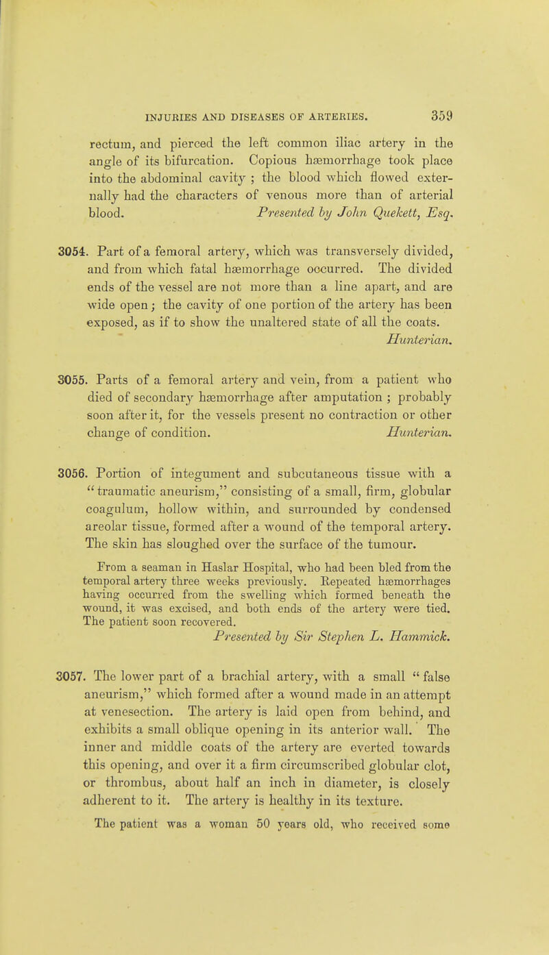 rectum, and pierced the left common iliac artery in the angle of its bifurcation. Copious hsemorrhage took place into the abdominal cavity ; the blood which flowed exter- nally had the characters of venous more than of arterial blood. Presented by John Quekett, Esq. 3054. Part of a femoral artery, which was transversely divided, and from which fatal hsemorrhage occurred. The divided ends of the vessel are not more than a line apart, and are wide open; the cavity of one portion of the artery has been exposed, as if to show the unaltered state of all the coats. Hunterian. 3055. Parts of a femoral artery and vein, from a patient who died of secondary hsemorrhage after amputation ; probably soon after it, for the vessels present no contraction or other change of condition. Hunterian. 3056. Portion of integument and subcutaneous tissue with a traumatic aneurism, consisting of a small, firm, globular coagulum, hollow within, and surrounded by condensed areolar tissue, formed after a wound of the temporal artery. The skin has sloughed over the surface of the tumour. Prom a seaman in Haslar Hospital, who had been bled from the temporal artery three weeks previously. Eepeated haemorrhages having occurred from the swelling which formed beneath the wound, it was excised, and both ends of the artery were tied. The patient soon recovered. Presented by Sir Stephen L. Hammick. 3057. The lower part of a brachial artery, with a small  false aneurism, which formed after a wound made in an attempt at venesection. The artery is laid open from behind, and exhibits a small oblique opening in its anterior wall. The inner and middle coats of the artery are everted towards this opening, and over it a firm circumscribed globular clot, or thrombus, about half an inch in diameter, is closely adherent to it. The artery is healthy in its texture. The patient was a woman 50 years old, who received some