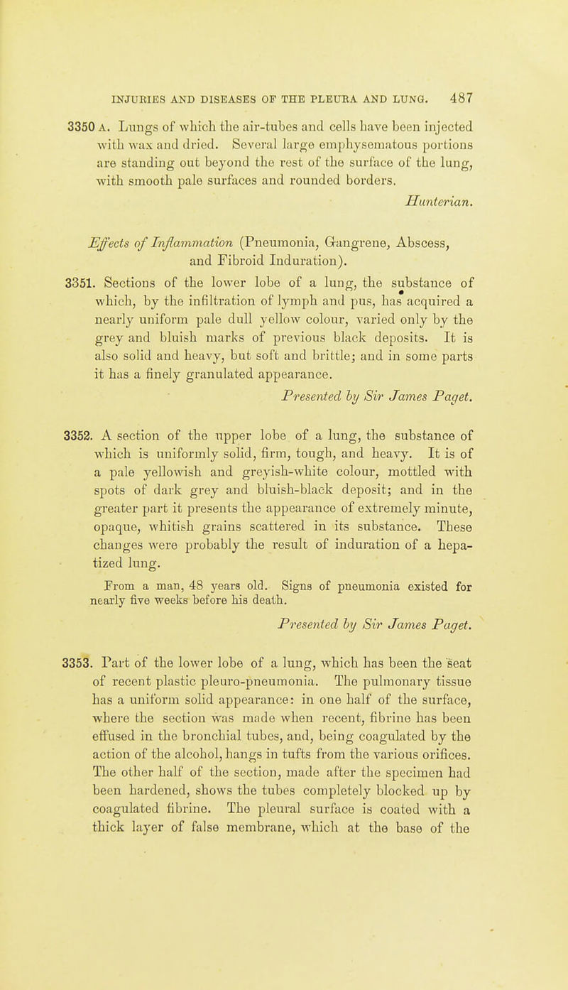3350 A. Lungs of which the air-tubes and cells have been injected with wax and dried. Several large emphysematous portions are standing out beyond the rest of the surface of the lung, with smooth pale surfaces and rounded borders. Hunterian. Effects of Inflammation (Pneumonia, Gangrene, Abscess, and Fibroid Induration). 3351. Sections of the lower lobe of a lung, the substance of which, by the infiltration of lymph and pus, has acquired a nearly uniform pale dull yellow colour, varied only by the grey and bluish marks of previous black deposits. It is also solid and heavy, but soft and brittle; and in some parts it has a finely granulated appearance. Presented hy Sir James Paget. 3352. A section of the upper lobe of a lung, the substance of which is uniformly solid, firm, tough, and heavy. It is of a pale yellowish and greyish-white colour, mottled w'ith spots of dark grey and bluish-black deposit; and in the greater part it presents the appearance of extremely minute, opaque, whitish grains scattered in its substance. These changes were probably the result of induration of a hepa- tized lung. From a man, 48 years old. Signs of pneumonia existed for nearly five weeks before his death. Presented hy Sir James Paget. 3353. Part of the lower lobe of a lung, which has been the seat of recent plastic pleuro-pneumonia. The pulmonary tissue has a uniform solid appearance: in one half of the surface, where the section was made when recent, fibrine has been effused in the bronchial tubes, and, being coagulated by the action of the alcohol, hangs in tufts from the various orifices. The other half of the section, made after the specimen had been hardened, shows the tubes completely blocked up by coagulated fibrine. The pleural surface is coated with a thick layer of false membrane, which at the base of the