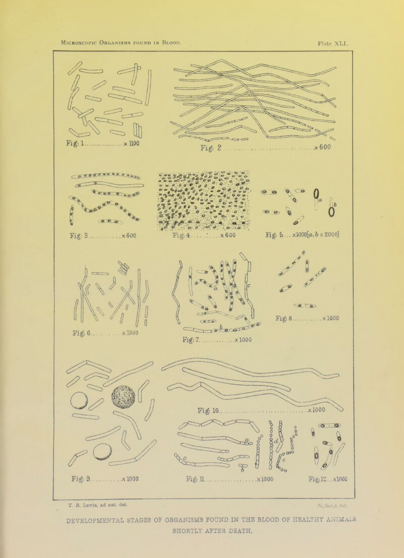 Fig: 9 xlOOO Fibril xlOOO Fig,-.12 xlOOC T. fi. Lewis, ad nat del. Tv/ace j>. 6vc. DEVELOPMENTAL STAGES Of ORGANISMS FOUND IN THE BLOOD OF HEALTHY ANIMALS SHORTLY ATTER DEATH.