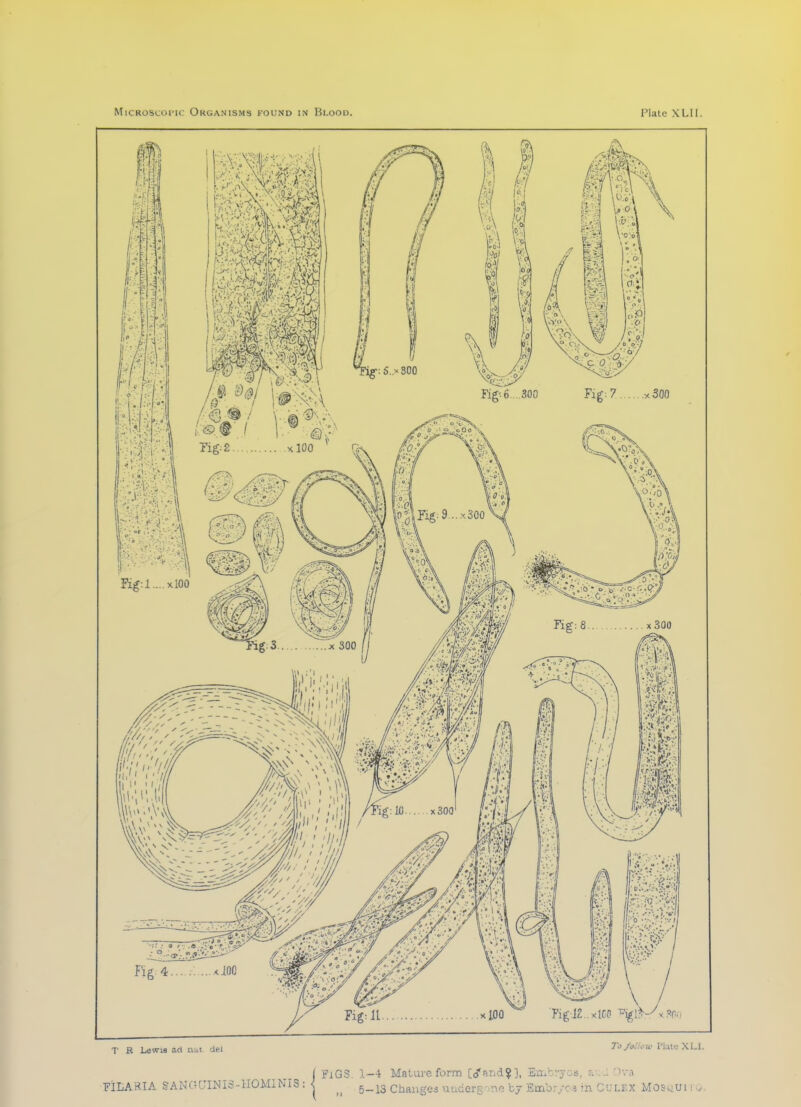 I FlGS. 1-4 Mature form [cfarid?], Embryos, a-...l :)va FiLARIA SANOLnNIS-HOMlNIS : I g_^3 changes uuders no bj Embryca m C'JLF.X MOSv;Ui ■ 0-