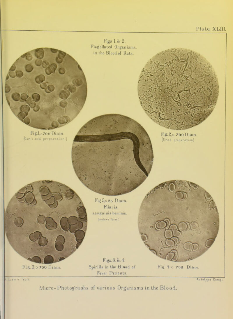 Fig-s \L2 Fkge Hated Or^a in the Blood of Hals. Fig.l,x70o Diam pomic acid -pi c-para : ' -i F'ig.i^.x zooDiam. [Dried preparation.] Fig.3,x 700 Diam. 0^ ^j^i^^i^HI^^ Fi^5,x25 Diam. Filaria. baiig'u i ms-hominis. [ma.ture form.] Figs. 3. ^4. Spirilla in the Blood of Fever Patients. r J Fi^ 4 X 700 Diam. i t. L s wi s Tecit. Autotype Comp.. Micro-Photographs of various Organisms in the Blood.