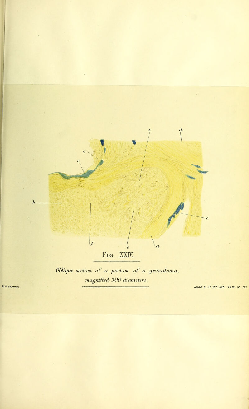 Pig. :xxiv: Oblique sectiorv of a portion of a. gramilomjh, magnified 300 diameters.
