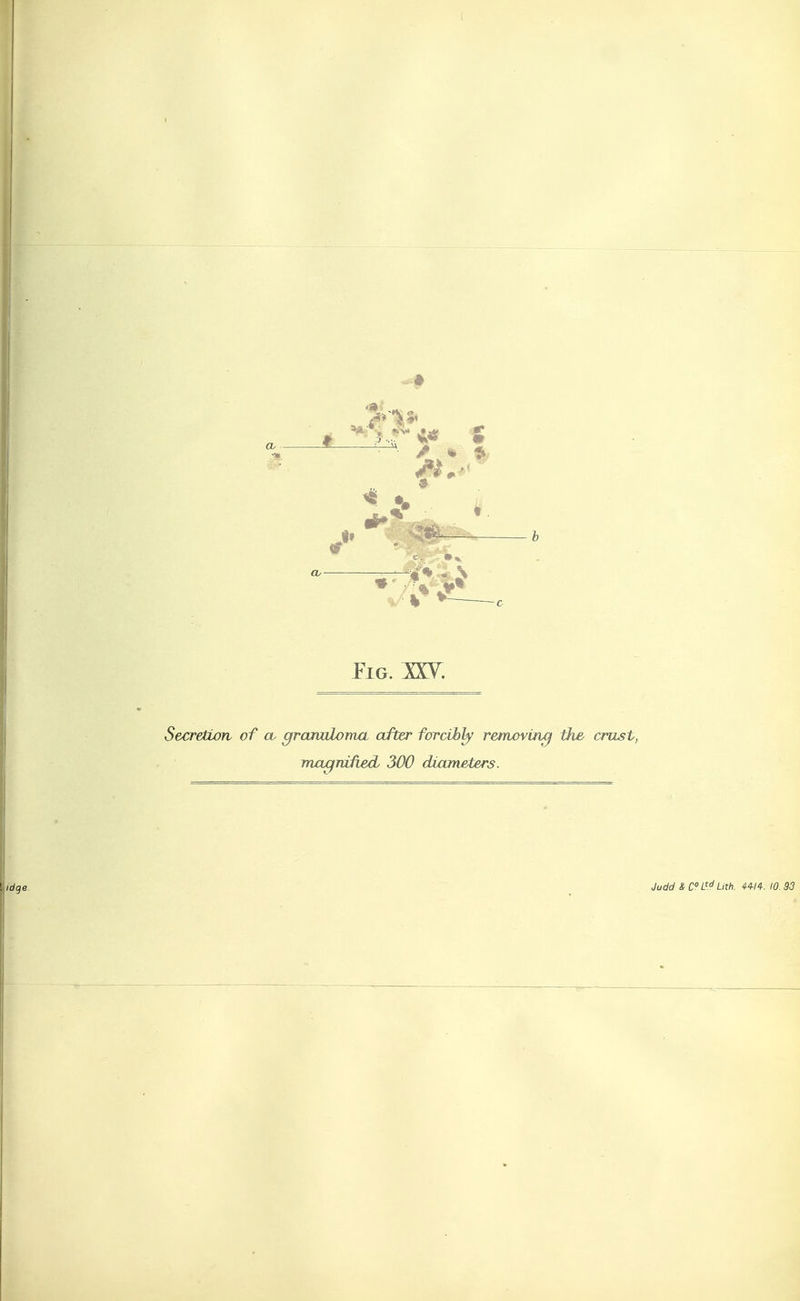 Cb - %/■ h ^ Pig. IXY. Secretion of cu granuloma after forcibly removing the crust, magnified^ 300 diameters.
