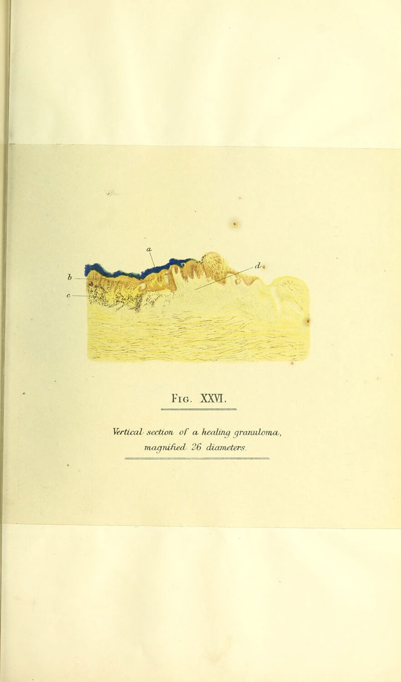 Yerticah section of cu healing grarwloiruv,