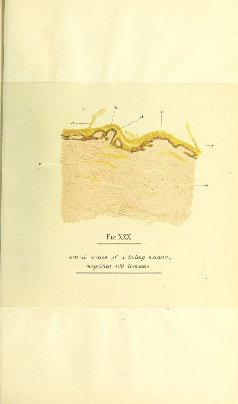 e YerticaL sectton of cu fading macuLcv, magmfi^d WO dxameters.