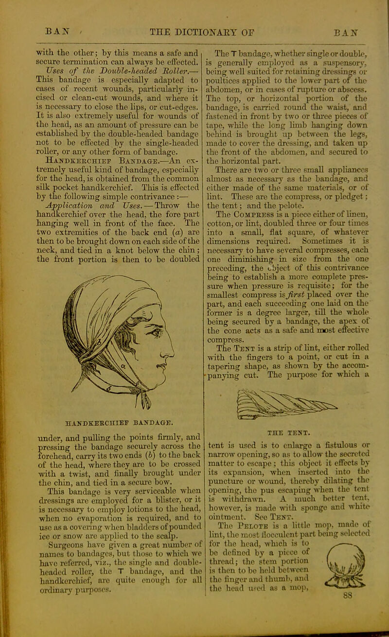 with the other; by this means a safe and secure termination can always be effected. Uses of the Double-headed Roller.— This bandage is especially adapted to coses of recent wounds, particularly in- cised or clean-cut woimds, and where it is necessary to close the lips, or cut-edges. It is also extremely useful for wounds of the head, as an amount of pressure can be established by the double-headed bandage not to be effected by the single-headed roUer, or any other form of bandage. Handkerchief Bandage.—An ex- tremely useful kind of bandage, especially for the head, is obtained from the common silk pocket handkerchief. This is effected by the following simple contrivance :— Application and Uses. — Throw the handkerchief over the head, the fore part hanging well in front of the face. The two extremities of the back end (a) are then to be brought down on each side of the neck, and tied m a knot below the chin; the front portion is then to be doubled HANDKEBCniEF BANDAGE. under, and pulling the points firmly, and pressing the bandage secui-ely across the forehead, carry its two ends (6) to the back of the head, where they arc to be crossed with a twist, and finally brought xmder the chin, and tied in a secui'e bow. This bandage is very serviceable when dressings are employed for a blister, or it is necessary to employ lotions to the head, when no evaporation is required, and to use as a covering when bladders of poiuidcd ice or snow arc applied to the scalp. Sui’geons have given a great number of names to bandages, but those to which we have referred, viz., the single and double- headed roller, the T bondage, and the handkerchief, arc quite enough for all ordinary purposes. The T bandage, whether single or double, is generally employed as a suspensory, being well suited for retaining dressings or poultices applied to the lower part of the abdomen, or in cases of rupture or abscess. The top, or horizontal portion of the bandage, is carried round the waist, and fastened in front by two or thi'ce pieces of tape, while the long limb hanging down behind is brought up between the legs, made to cover the dressing, and taken up the front of the abdomen, and secured to the horizontal part. There are two or three small appliances ahnost as necessaiy as the bandage, and either made of the same materials, or of lint. These are the compress, or pledget; the tent; and the pelote. The CoHPEESS is a piece either of linen, cotton, or lint, doubled three or four times into a small, flat square, of whatever dimensions required. Sometimes it is necessary to have several compresses, each one diminishing in size from the one preceding, the object of this contrivance being to establish a more complete pres- sure when pressure is requisite; for the smallest compress is first placed over the part, and each succeeding one laid on the former is a degree larger, till the whole being seemed by a bandage, the apex of the cone acts as a safe and most effective compress. The Tent is a strip of lint, either roDed with the fingers to a point, or cut in a tapering shape, as shown by the accom- 'punying cut. The purpose for which a tent is used is to enlarge a fistulous or narrow opening, so as to allow the secreted matter to escape; this object it effects by its expansion, when inserted into the puncture or wound, thereby dilating the opening, the pus escaping when the tent is withdrami. A much better tent, however, is made •with sponge and white ointment. See Tent. The Pelote is a little mop, made of lint, the most ilocculcnt part being selected for the head, Avhich is to be defined by a piece of thread; the stem portion is then to bo held bet ween the finger and thumb, and the head ii^ed as a mop,