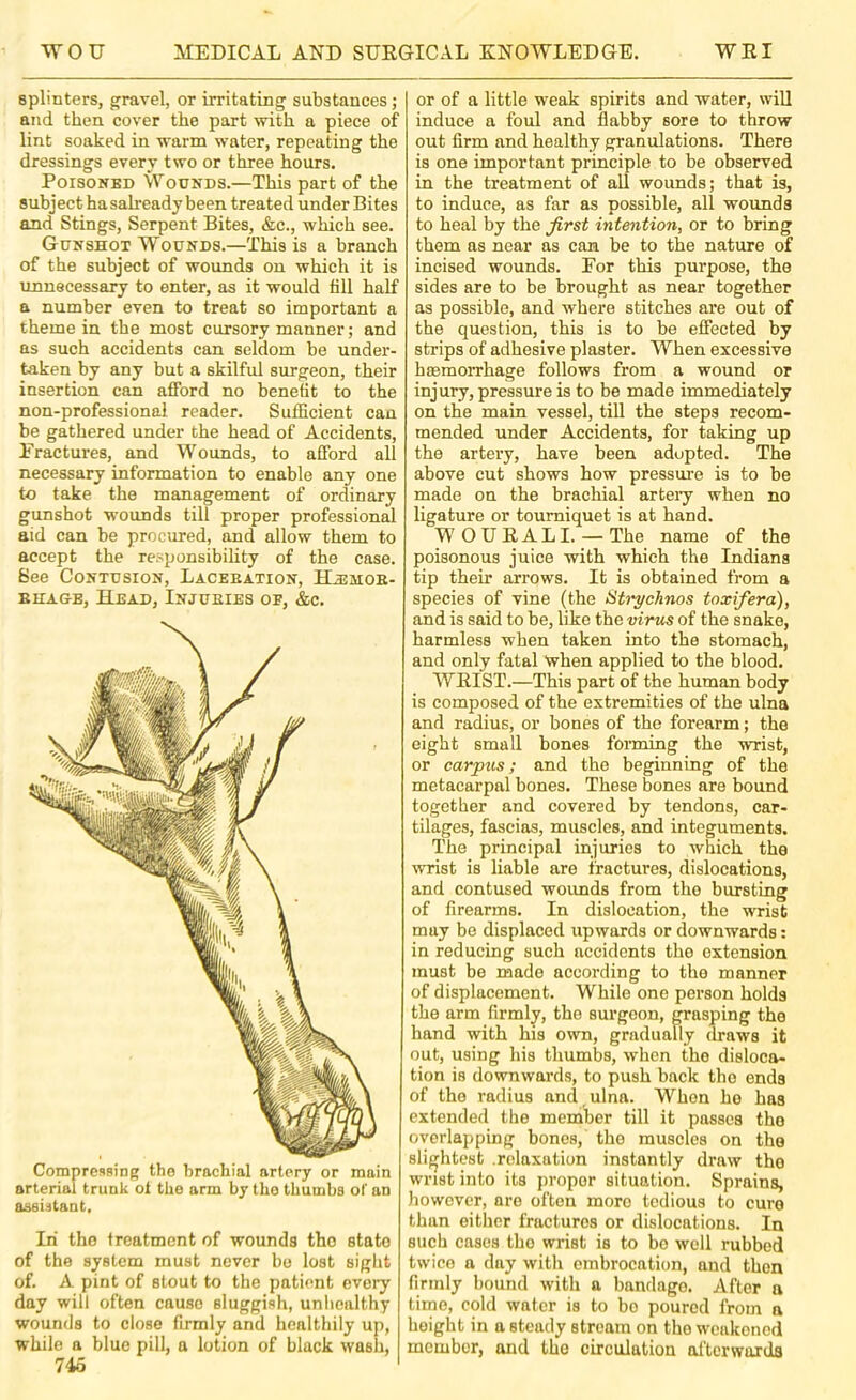 splinters, gravel, or irritating substances; and then cover the part with a piece of lint soaked in warm water, repeating the dressings every two or three hours. Poisoned Wounds.—This part of the subject hasalready been treated under Bites and Stings, Serpent Bites, &c., which see. Gunshot Wounds.—This is a branch of the subject of wounds on which it is unnecessary to enter, as it would fill half a number even to treat so important a theme in the most cursory manner; and as such accidents can seldom be under- taken by any but a skilful surgeon, their insertion can afford no benefit to the non-professional reader. Sufficient can be gathered under the head of Accidents, Eractures, and Wounds, to afford all necessary information to enable any one to take the management of ordinary gunshot wounds till proper profession^ aid can be procured, and allow them to accept the responsibihty of the case. See Contusion, Laceeation, Hasmoe- BHAGE, Head, Injueies of, &c. Compressing the brachial artery or main arterial trunk of the arm by the thumbs of an assUtant. In the treatment of wounds the state of the system must never bo lost sight of. A pint of stout to the patient eveiy day will often cause sluggish, unhealthy wounds to close firmly and healthily up, while a blue pill, a lotion of black wash, 745 or of a little weak spirits and water, will induce a foul and flabby sore to throw out firm and healthy granulations. There is one important principle to be observed in the treatment of all wounds; that is, to induce, as far as possible, all wounds to heal by the first intention, or to bring them as near as can be to the nature of incised wounds. For this purpose, the sides are to be brought as near together as possible, and where stitches are out of the question, this is to be effected by strips of adhesive plaster. When excessive haemoiThage follows from a wound or injury, pressure is to be made immediately on the main vessel, till the steps recom- mended under Accidents, for taking up the artery, have been adopted. The above cut shows how pressure is to be made on the brachial arteiy when no ligature or tourniquet is at hand. WOUEALI. — The name of the poisonous juice with which the Indians tip their arrows. It is obtained from a species of vine (the Strychnos toxifera), and is said to be, like the virus of the snake, harmless when taken into the stomach, and only fatal when applied to the blood. WEIST.—This part of the human body is composed of the extremities of the ulna and radius, or bones of the forearm; the eight small bones forming the wrist, or carpzcs; and the beginning of the metacarpal bones. These bones are bound together and covered by tendons, car- tilages, fascias, muscles, and integuments. The principal injuries to which the wrist is liable are fractures, dislocations, and contused woimds from the bursting of firearms. In dislocation, the wrist may be displaced upwards or downwards; in reducing such accidents the extension must be made according to the manner of displacement. While one person holds the arm firmly, the surgeon, grasping the hand with his own, gradually draws it out, using his thumbs, when the disloca- tion is downwards, to push back the ends of the radius and ^ ulna. When ho has extended the member till it passes the overlapping bones, the muscles on the slightest .relaxation instantly draw the wrist into its proper situation. Sprains, however, are often more tedious to cure than either fractures or dislocations. In such cases the wrist is to bo well rubbed twice a day with embrocation, and then firmly bound with a bandage. After a time, cold water is to bo poured from a height in a steady stream on the weakened member, and the circulation afterwords