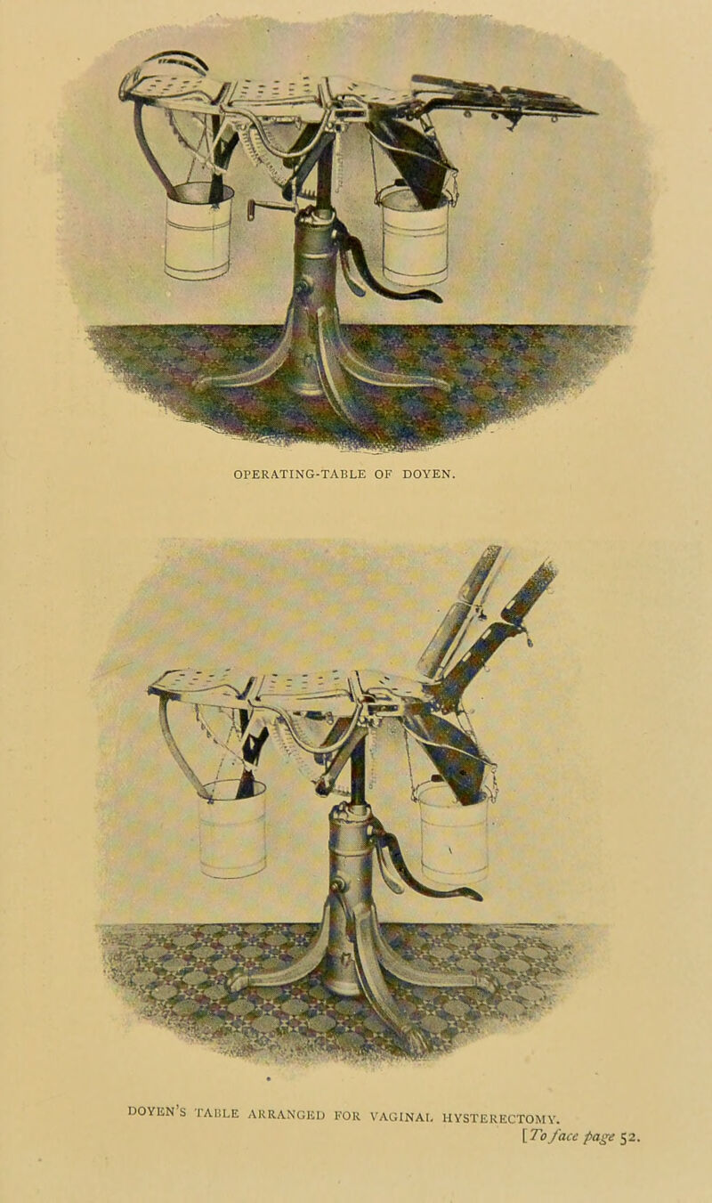 OPERATING-TABLE OF DOYEN. DOYEN S TABLE ARRANGED FOR VAGINAL HYSTERECTOMY.