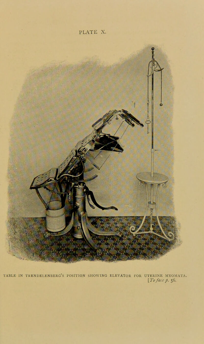 TABLE IN TRENUEI.ENBERG’S POSITION SHOWING ELEVATOR KOR UTERINE MYOMATA. [Zipfacep. 56.