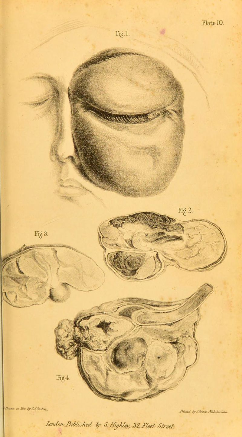 /Mum c/t Zinc by C*ZQtrtUn.. /hrAd byJGriK+.*Mc}tc!a*rto%+ londonMfchcd by S.JfyMty, 32,Met/ Street