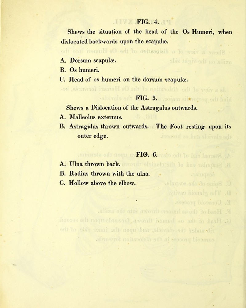 Shews the situation of the head of the Os Humeri, when dislocated backwards upon the scapulae. A. Dorsum scapulae. B. Os humeri. C. Head of os humeri on the dorsum scapulae. FIG. 5. Shews a Dislocation of the Astragalus outwards. A. Malleolus externus. B. Astragalus thrown outwards. The Foot resting upon its outer edge. FIG. 6. A. Ulna thrown back. B. Radius thrown with the ulna. C. rioUow above the elbow.