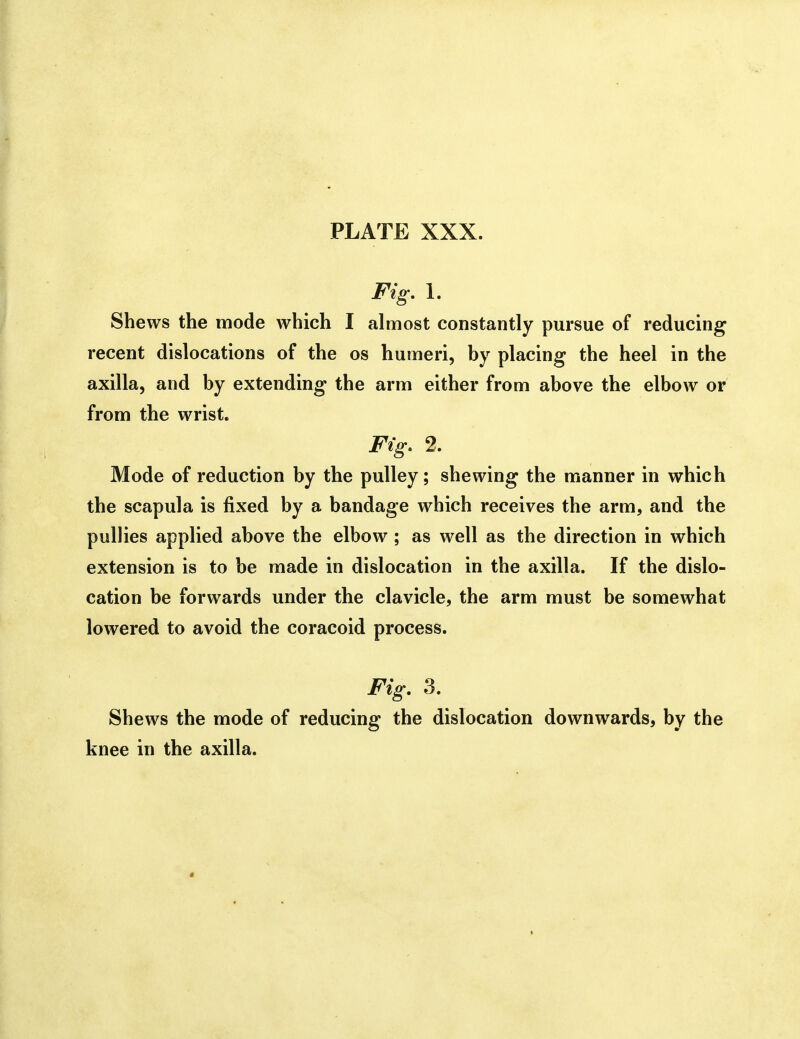 Fig, 1. Shews the mode which I almost constantly pursue of reducing recent dislocations of the os humeri, by placing the heel in the axilla, and by extending the arm either from above the elbow or from the wrist. Fig, 2. Mode of reduction by the pulley; shewing the manner in which the scapula is fixed by a bandage which receives the arm, and the puUies applied above the elbow ; as well as the direction in which extension is to be made in dislocation in the axilla. If the dislo- cation be forwards under the clavicle, the arm must be somewhat lowered to avoid the coracoid process. Fig. 3. Shews the mode of reducing the dislocation downwards, by the knee in the axilla.