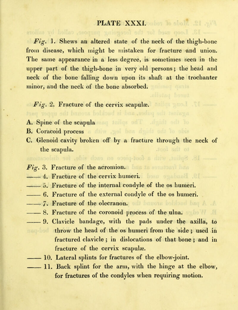 Fig, ]. Shews an altered state of the neck of the thigh-bone from disease, which might be mistaken for fracture and union. The same appearance in a less degree, is sometimes seen in the upper part of the thigh-bone in very old persons; the head and neck of the bone falling down upon its shaft at the trochanter minor, and the neck of the bone absorbed. Fig, 2. Fracture of the cervix scapulae. A. Spine of the scapula B. Coracoid process C. Glenoid cavity broken off by a fracture through the neck of the scapula. Fig, 3. Fracture of the acromion. 4. Fracture of the cervix humeri. 5, Fracture of the internal condyle of the os humeri. 6. Fracture of the external condyle of the os humeri. —— 7. Fracture of the olecranon. 8. Fracture of the coronoid process of the ulna. 9. Clavicle bandage, with the pads under the axilla, to throw the head of the os humeri from the side ; used in fractured clavicle ; in dislocations of that bone ; and in fracture of the cervix scapulae. 10. Lateral splints for fractures of the elbow-joint. 11. Back splint for the arm, with the hinge at the elbow, for fractures of the condyles when requiring motion.