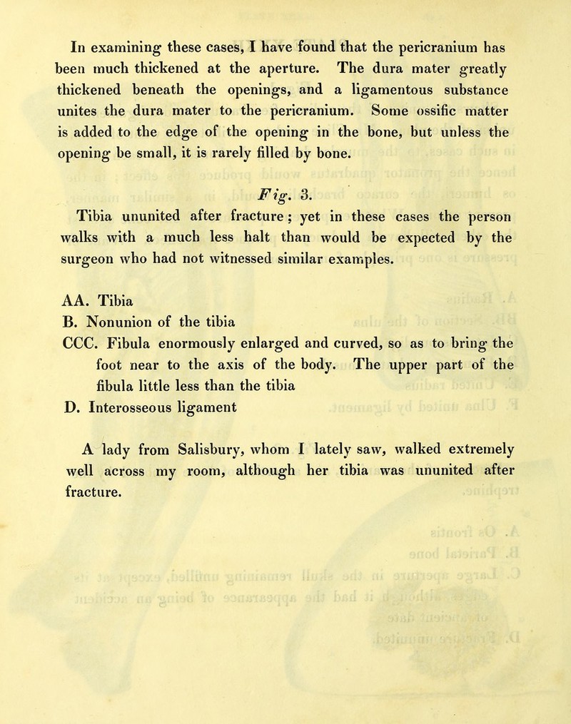 In examining these cases, I have found that the pericranium has heen much thickened at the aperture. The dura mater greatly thickened heneath the openings, and a ligamentous substance unites the dura mater to the pericranium. Some ossific matter is added to the edge of the opening in the bone, but unless the opening be small, it is rarely filled by bone. Fig, 3. Tibia ununited after fracture; yet in these cases the person walks with a much less halt than would be expected by the surgeon who had not witnessed similar examples. AA. Tibia B. Nonunion of the tibia CCC. Fibula enormously enlarged and curved, so as to bring the foot near to the axis of the body. The upper part of the fibula little less than the tibia D. Interosseous ligament A lady from Salisbury, whom I lately saw, walked extremely well across my room, although her tibia was ununited after fracture.