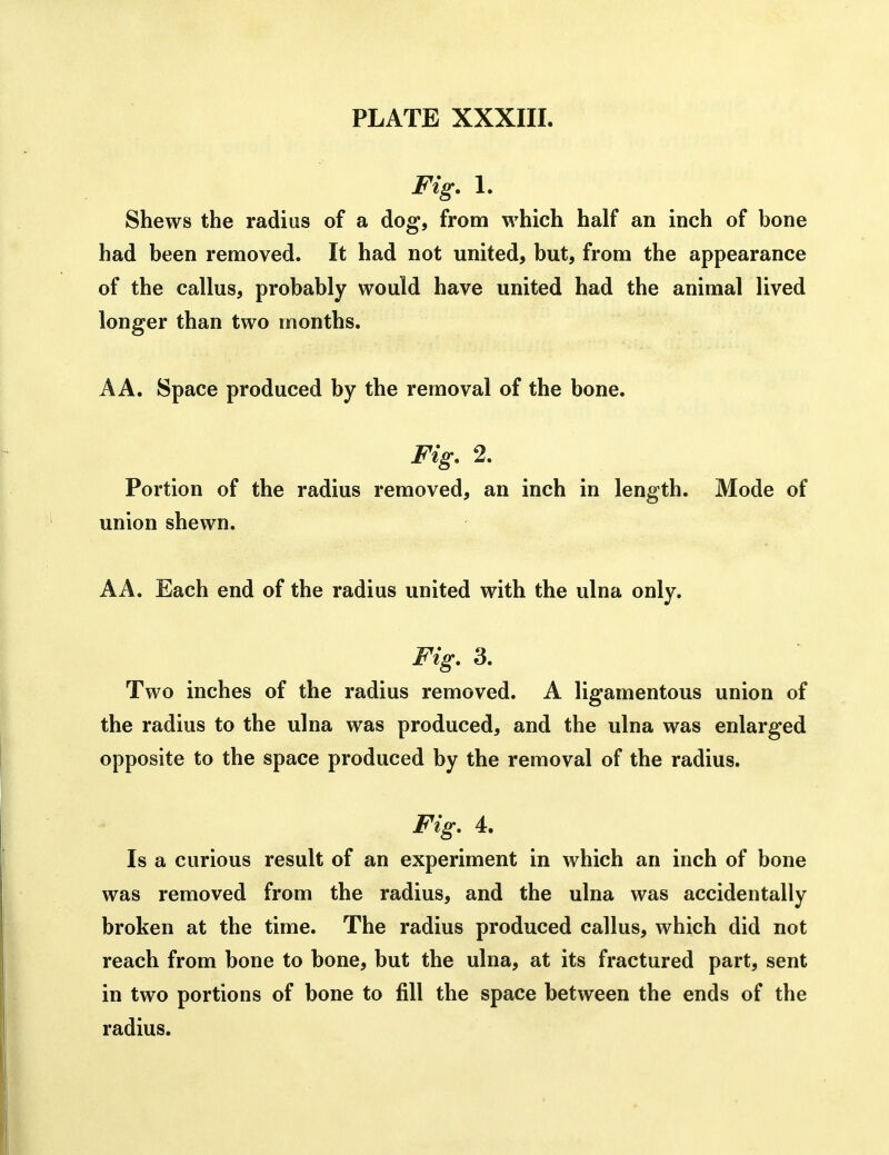 Fig. 1. Shews the radius of a dog, from which half an inch of bone had been removed. It had not united, but, from the appearance of the callus, probably would have united had the animal lived longer than two months. A A. Space produced by the removal of the bone. Fig. 2. Portion of the radius removed, an inch in length. Mode of union shewn. AA. Each end of the radius united with the ulna only. Fig. 3. Two inches of the radius removed. A ligamentous union of the radius to the ulna was produced, and the ulna was enlarged opposite to the space produced by the removal of the radius. Fig. 4, Is a curious result of an experiment in which an inch of bone was removed from the radius, and the ulna was accidentally broken at the time. The radius produced callus, which did not reach from bone to bone, but the ulna, at its fractured part, sent in two portions of bone to fill the space between the ends of the radius.