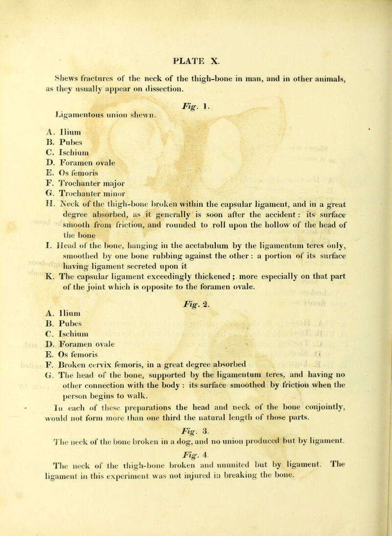 Shews fractures of the neck of the thigh-bone in man, and in other animals, as they sisually appear on dissection. Fig. 1. Ligamentous union shewn. A. Ilium B. Pubes C. Ischium D. Foramen ovale E. Os femoris F. Trochanter major G. Trochanter minor H. Neck of the thigh-bone broken within the capsular ligament, and in a great degree absorbed, as it generally is soon after the accident : its surface smooth from friction, and rounded to roll upon the hollow of the head of the bone I. Head of the bone, hanging in the acetabulum by the ligamentum teres only, smoothed by one bone rubbing against the other : a portion of its surface having ligament secreted upon it K. The capsular ligament exceedingly thickened; more especially on that part of the joint which is opposite to the foramen ovale. Fig. 2. A. Ilium B. Pubes C. Ischium D. Foramen ovale E. Os femoris F. Broken cervix femoris, in a great degree absorbed G. The head of the bone, supported by the ligamentum teres, and having no other connection with the body : its surface smoothed by friction when the person begins to walk. In each of these preparations the head and neck of the bone conjointly, would not form more than one third the natural length of those parts. Fig. 3. 1 he neck of the bone broken in a dog, and no union produced but by ligament. Fig. 4. The neck of the thigh-bone broken and ununited but by ligament. The ligament in this experiment was not injured \i\ breaking the bone.