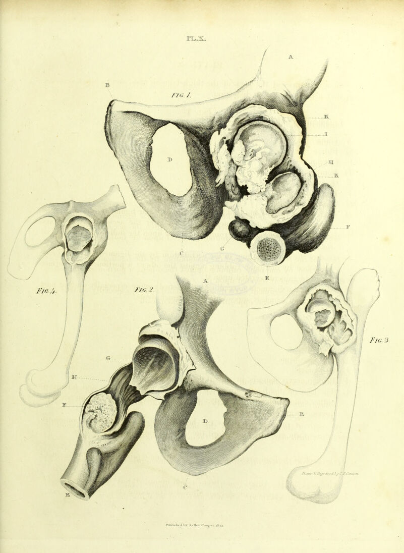 rill J i si Le fll) V As tie J C. u r^i er. iH -i 2.