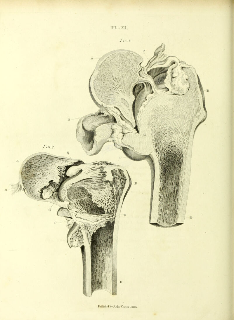 TIL .XI, Tia.l. I 'ililisli.vl In- Astlc-v Ciiojier , 1825.