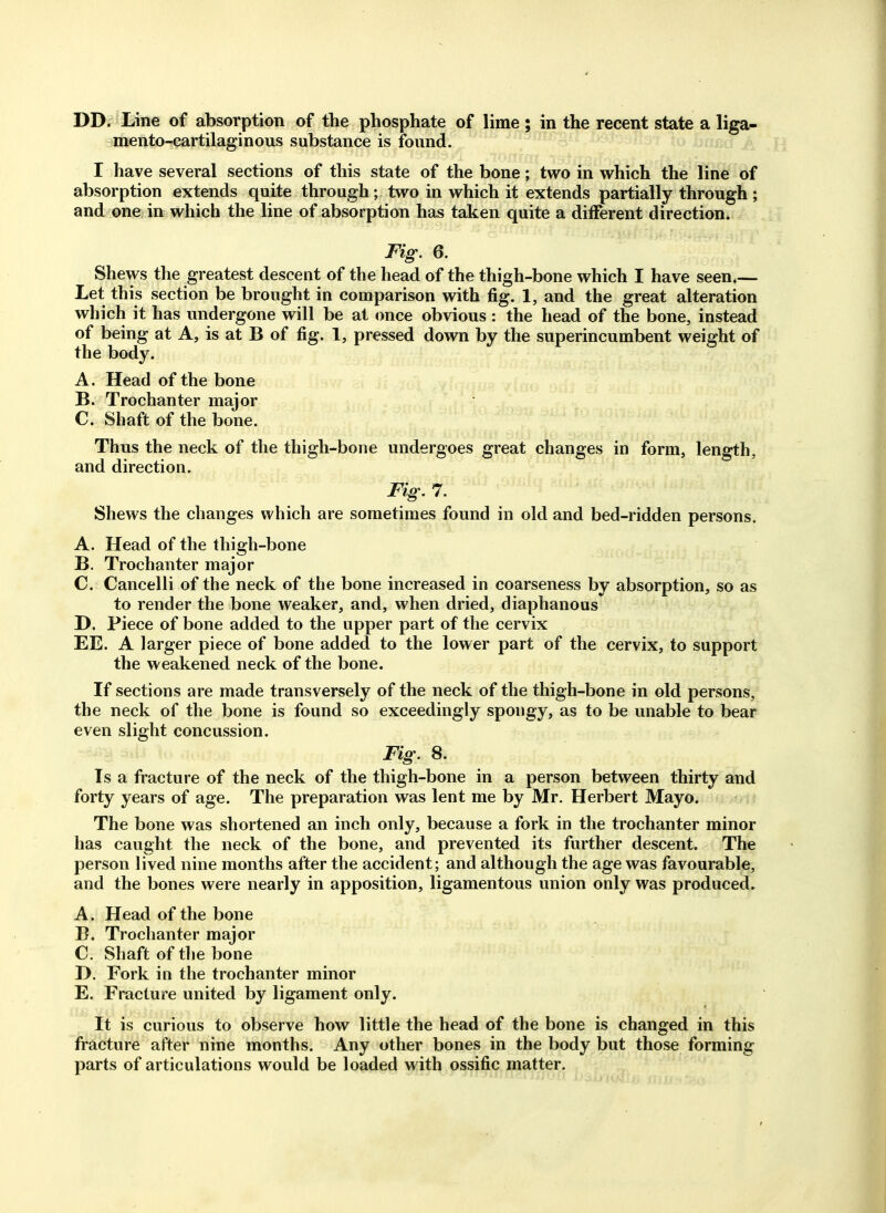 DD. Line of absorption of the phosphate of lime ; in the recent state a liga- mento-cartilaginous substance is found. I have several sections of this state of the bone; two in which the line of absorption extends quite through; two in which it extends partially through ; and one in which the line of absorption has taken quite a different direction. Fig. 6. Shews the greatest descent of the head of the thigh-bone which I have seen.— Let this section be brought in comparison with fig. 1, and the great alteration which it has undergone will be at once obvious : the head of the bone, instead of being at A, is at B of fig. 1, pressed down by the superincumbent weight of the body. A. Head of the bone B. Trochanter major C. Shaft of the bone. Thus the neck of the thigh-bone undergoes great changes in form, length, and direction. Fig. 7. Shews the changes which are sometimes found in old and bed-ridden persons. A. Head of the thigh-bone B. Trochanter major C. Cancelli of the neck of the bone increased in coarseness by absorption, so as to render the bone weaker, and, when dried, diaphanous D. Piece of bone added to the upper part of the cervix EE. A larger piece of bone added to the lower part of the cervix, to support the weakened neck of the bone. If sections are made transversely of the neck of the thigh-bone in old persons, the neck of the bone is found so exceedingly spongy, as to be unable to bear even slight concussion. FigJS. Is a fracture of the neck of the thigh-bone in a person between thirty and forty years of age. The preparation was lent me by Mr. Herbert Mayo. The bone was shortened an inch only, because a fork in the trochanter minor has caught the neck of the bone, and prevented its further descent. The person lived nine months after the accident ; and although the age was favourable, and the bones were nearly in apposition, ligamentous union only was produced. A. Head of the bone B. Trochanter major C. Shaft of the bone D. Fork in the trochanter minor E. Fracture united by ligament only. It is curious to observe how little the head of the bone is changed in this fracture after nine months. Any other bones in the body but those forming parts of articulations would be loaded with ossific matter.
