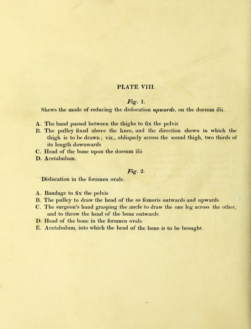 Fig' 1. Shews the mode of reducing the dislocation upwards, on the dorsum ilii. A. The band passed between the thighs to fix the pelvis B. The pulley fixed above the knee, and the direction shewn in which the thigh is to be drawn ; viz., obliquely across the sound thigh, two thirds of its length downwards C. Head of the bone upon the dorsum ilii D. Acetabulum. Fig. 2. Dislocation in the foramen ovale. A. Bandage to fix the pelvis B. The pulley to draw the head of the os femoris outwards and upwards C. The surgeon's hand grasping the ancle to draw the one leg across the other, and to throw the head of the bone outwards D. Head of the bone in the foramen ovale E. Acetabulum, into which the head of the bone is to be brought.