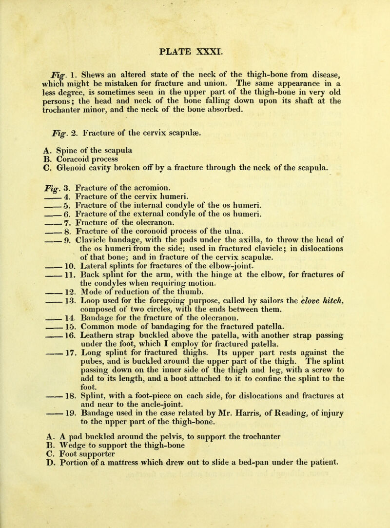 Fig. 1. Shews an altered state of the neck of the thigh-bone from disease, which might be mistaken for fracture and union. The same appearance in a less degree, is sometimes seen in the upper part of the thigh-bone in very old persons; the head and neck of the bone falling down upon its shaft at the trochanter minor, and the neck of the bone absorbed. Fig. 2. Fracture of the cervix scapulae. A. Spine of the scapula B. Coracoid process C. Glenoid cavity broken otT by a fracture through the neck of the scapula. Fig. 3. Fracture of the acromion. 4. Fracture of the cervix humeri. 5. Fracture of the internal condyle of the os humeri. 6. Fracture of the external condyle of the os humeri. 7. Fracture of the olecranon. 8. Fracture of the coronoid process of the ulna. 9. Clavicle bandage, with the pads under the axilla, to throw the head of the OS humeri from the side; used in fractured clavicle; in dislocations of that bone; and in fracture of the cervix scapulae. 10. Lateral splints for fractures of the elbow-joint. 11. Back splint for the arm, with the hinge at the elbow, for fractures of the condyles when requiring motion. 12. Mode of reduction of the thumb. 13. Loop used for the foregoing purpose, called by sailors the clove hitch, composed of two circles, with the ends between them. 14. Bandage for the fracture of the olecranon. 15. Common mode of bandaging for the fractured patella. —16. Leathern strap buckled above the patella, with another strap passing under the foot, which I employ for fractured patella. 17. Long splint for fractured thighs. Its upper part rests against the pubes, and is buckled around the upper part of the thigh. The splint passing down on the inner side of the thigh and leg, with a screw to add to its length, and a boot attached to it to confine the splint to the foot. 18. Splint, with a foot-piece on each side, for dislocations and fractures at and near to the ancle-joint. 19. Bandage used in the case related by Mr. Harris, of Reading, of injury to the upper part of the thigh-bone. A. A pad buckled around the pelvis, to support the trochanter B. Wedge to support the thigh-bone C. Foot supporter D. Portion of a mattress which drew out to slide a bed-pan under the patient.