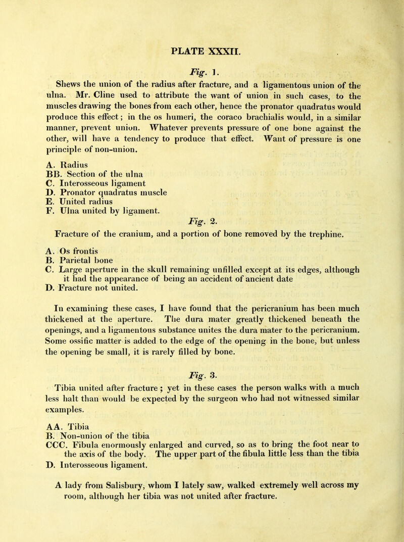Fig, 1. Shews the union of the radius after fracture, and a ligamentous union of the ulna. Mr. Cline used to attribute the want of union in such cases, to the muscles drawing the bones from each other, hence the pronator quadratus would produce this effect; in the os humeri, the coraco brachialis would, in a similar manner, prevent union. Whatever prevents pressure of one bone against the other, will have a tendency to produce that effect. Want of pressure is one principle of non-union. A. Radius BB. Section of the ulna C. Interosseous ligament D. Pronator quadratus muscle E. United radius F. Ulna united by ligament. Fig. 2. Fracture of the cranium, and a portion of bone removed by the trephine. A. Os frontis B. Parietal bone C. Large aperture in the skull remaining unfilled except at its edges, although it had the appearance of being an accident of ancient date D. Fracture not united. In examining these cases, I have found that the pericranium has been much thickened at the aperture. The dura mater greatly thickened beneath the openings, and a ligamentous substance unites the dura mater to the pericranium. Some ossific matter is added to the edge of the opening in the bone, but unless the opening be small, it is rarely filled by bone. Fig. 3. Tibia united after fracture ; yet in these cases the person walks with a much less halt than would be expected by the surgeon who had not witnessed similar examples. AA. Tibia B. Non-union of the tibia CCC. Fibula enormously enlarged and curved, so as to bring the foot near to the axis of the body. The upper part of the fibula little less than the tibia D. Interosseous ligament. A lady from Salisbury, whom I lately saw, walked extremely well across my room, although her tibia was not united after fracture.
