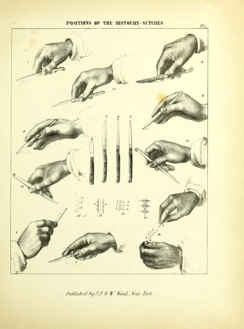 POSITIONS OF THE BISTOrRY-SUTURES